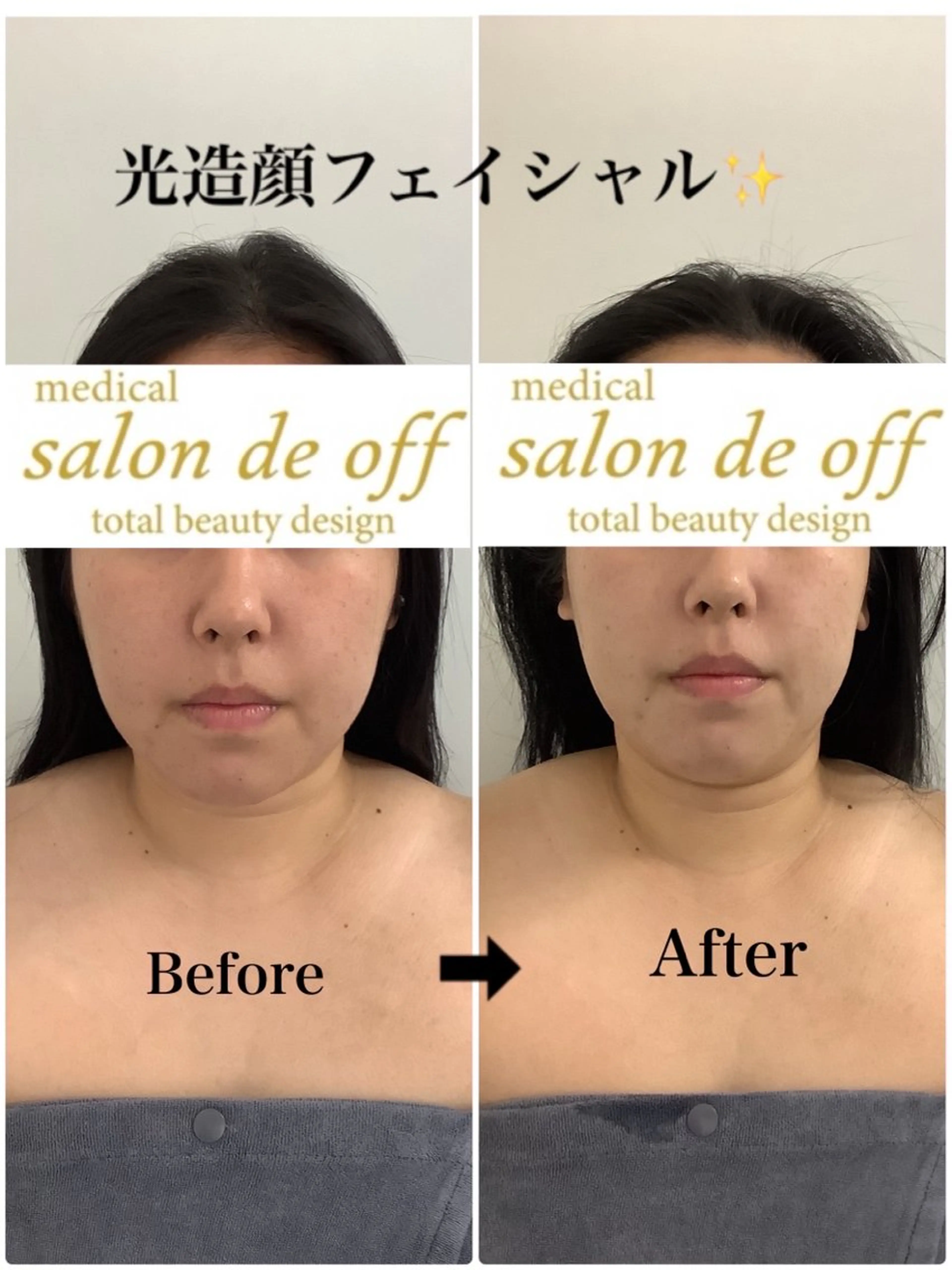 エステ リラク 🩵Tatsumi Kana🩵のエステ・リラクイメージ