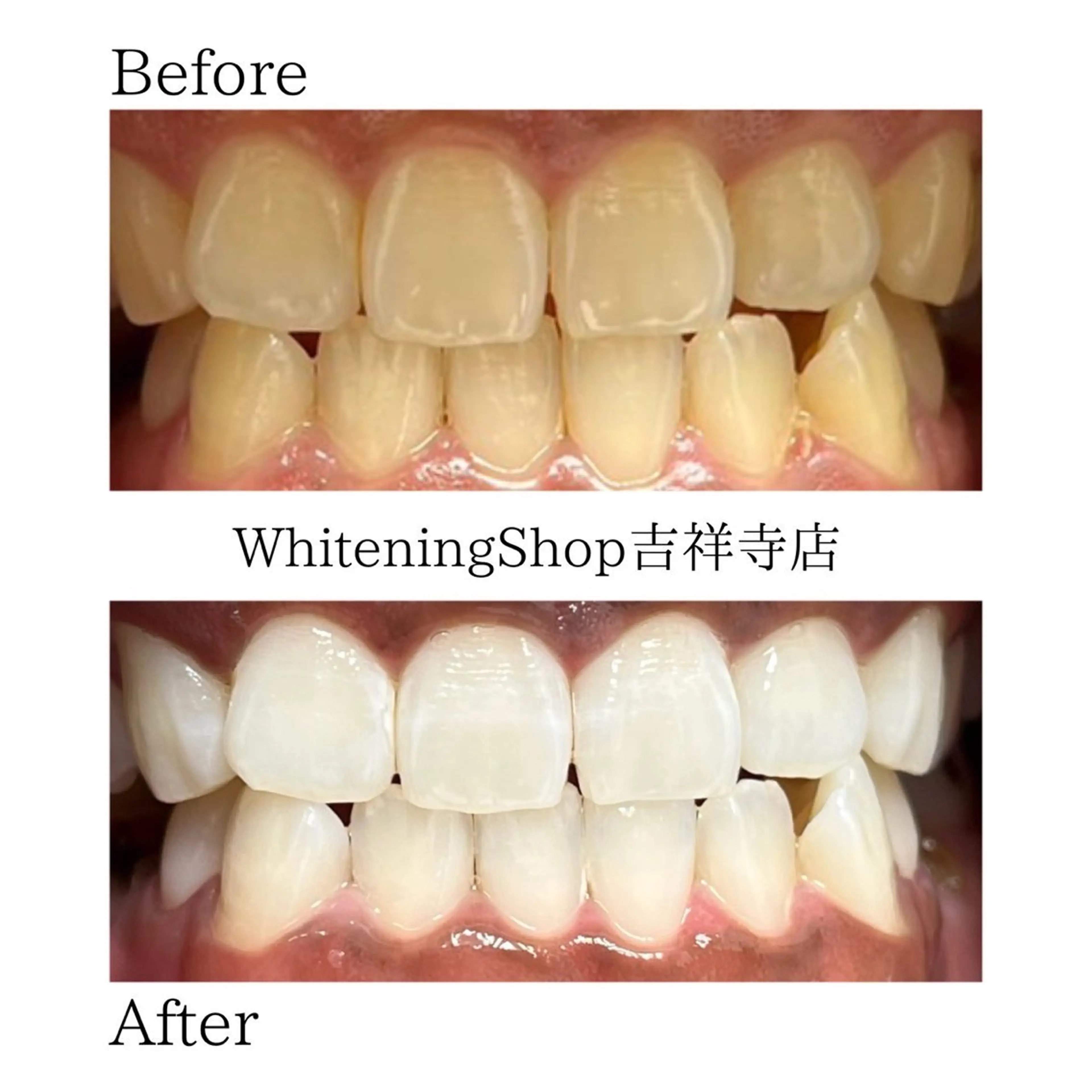 エステ リラク ホワイトニング ショップ吉祥寺店のエステ・リラクイメージ