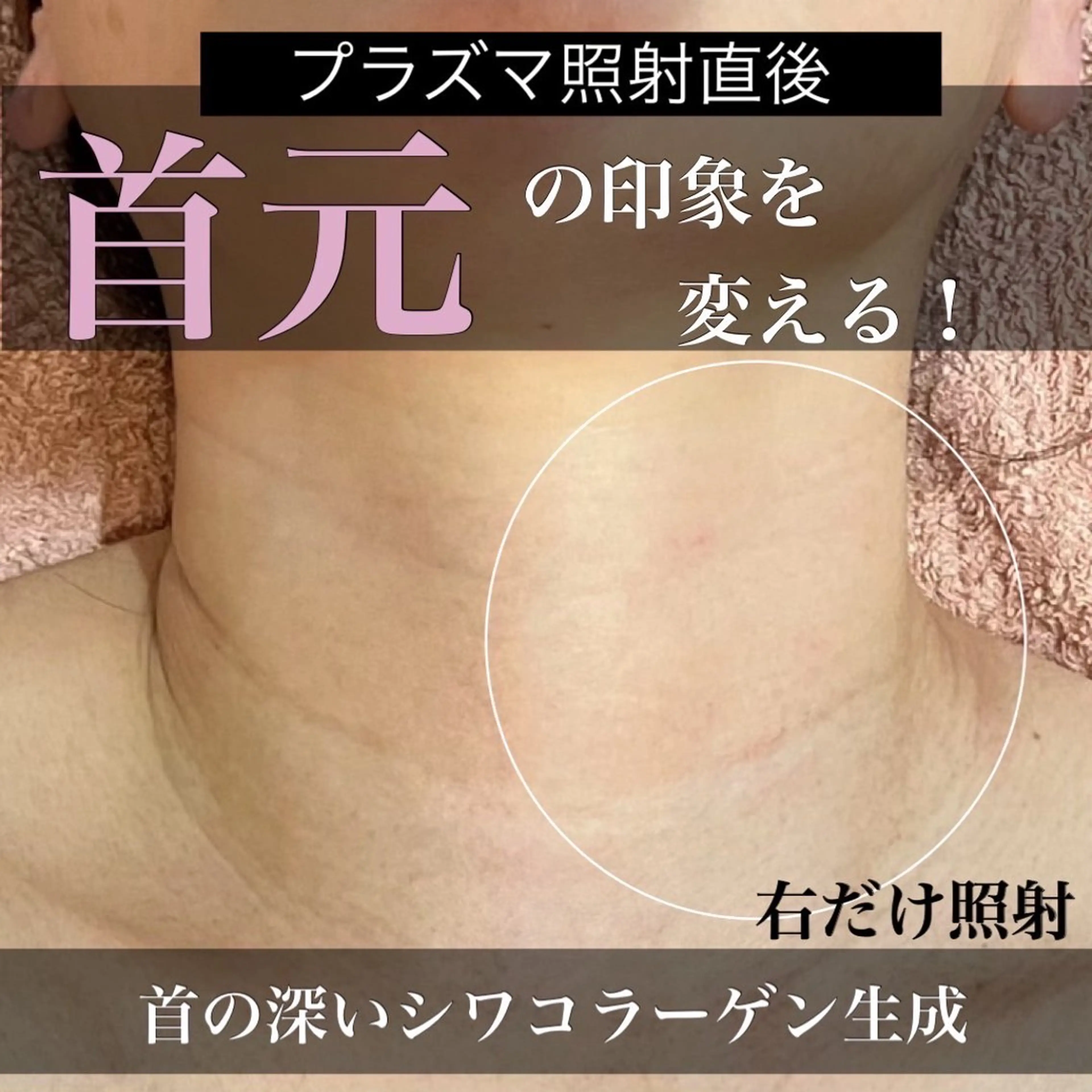 エステ トータルエステサロン Tiaraのエステ・リラクイメージ