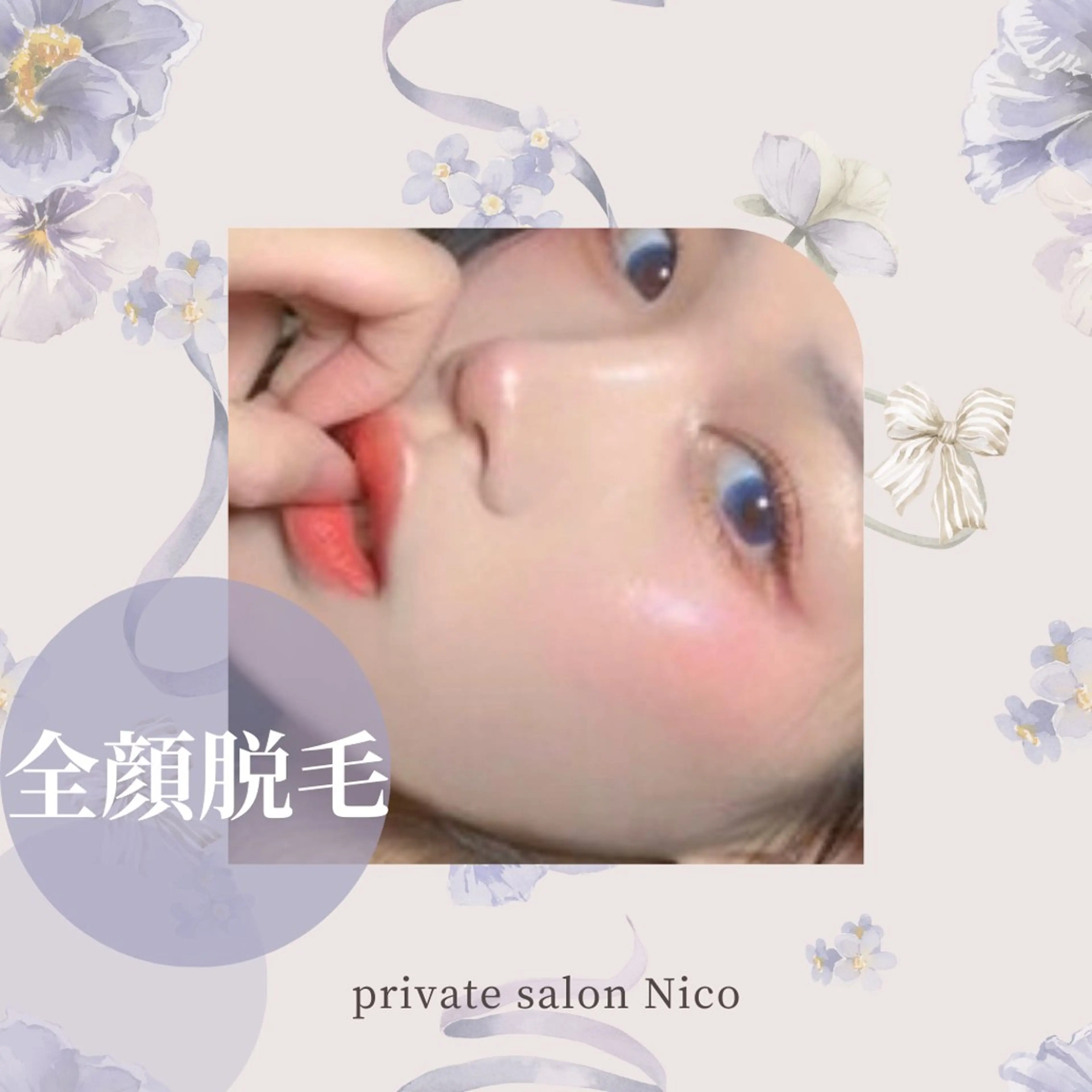 脱毛 美肌脱毛&毛穴専門 Nico🐰ྀི♡のエステ・リラクイメージ