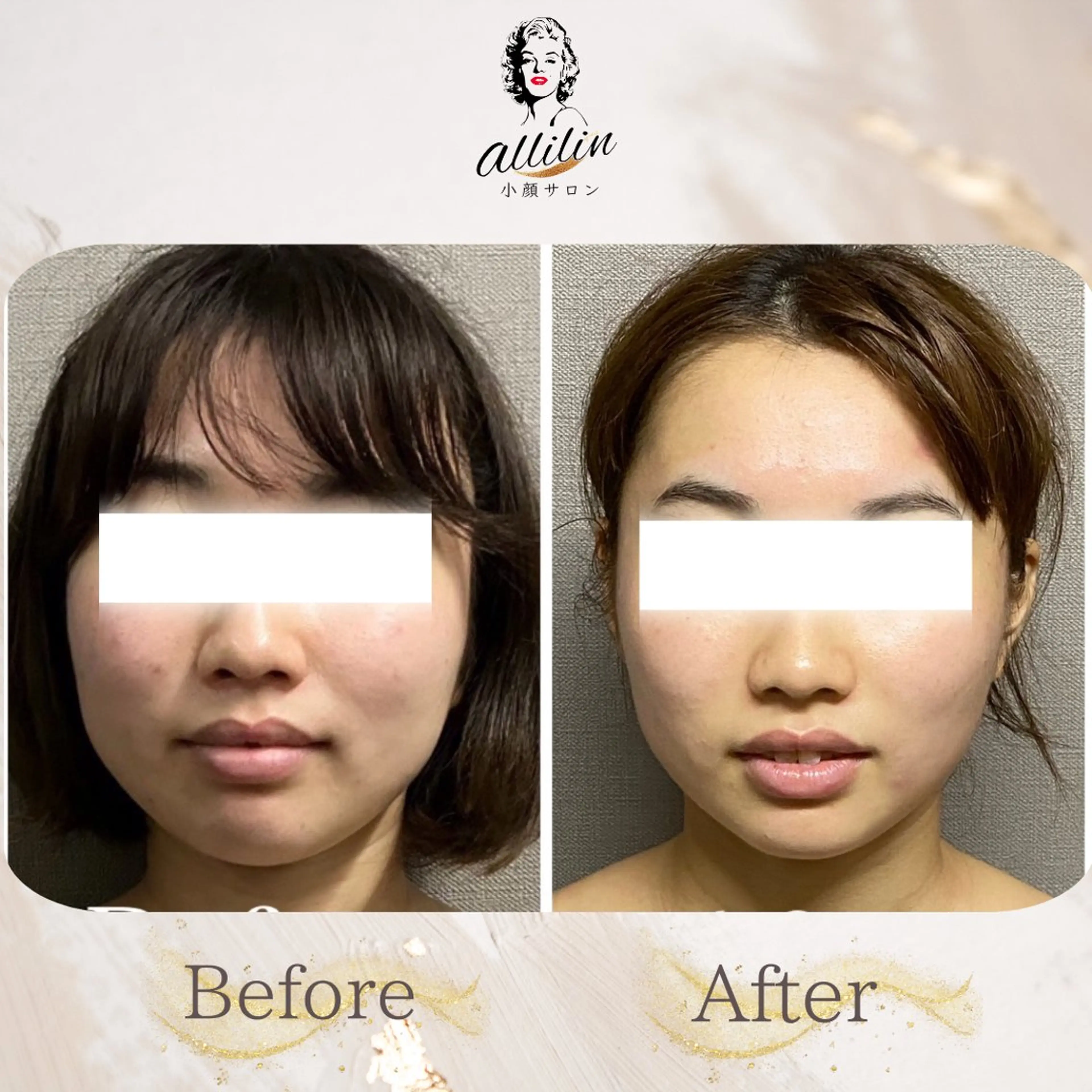 💎allilin 五所川原💎本間のエステ・リラクイメージ