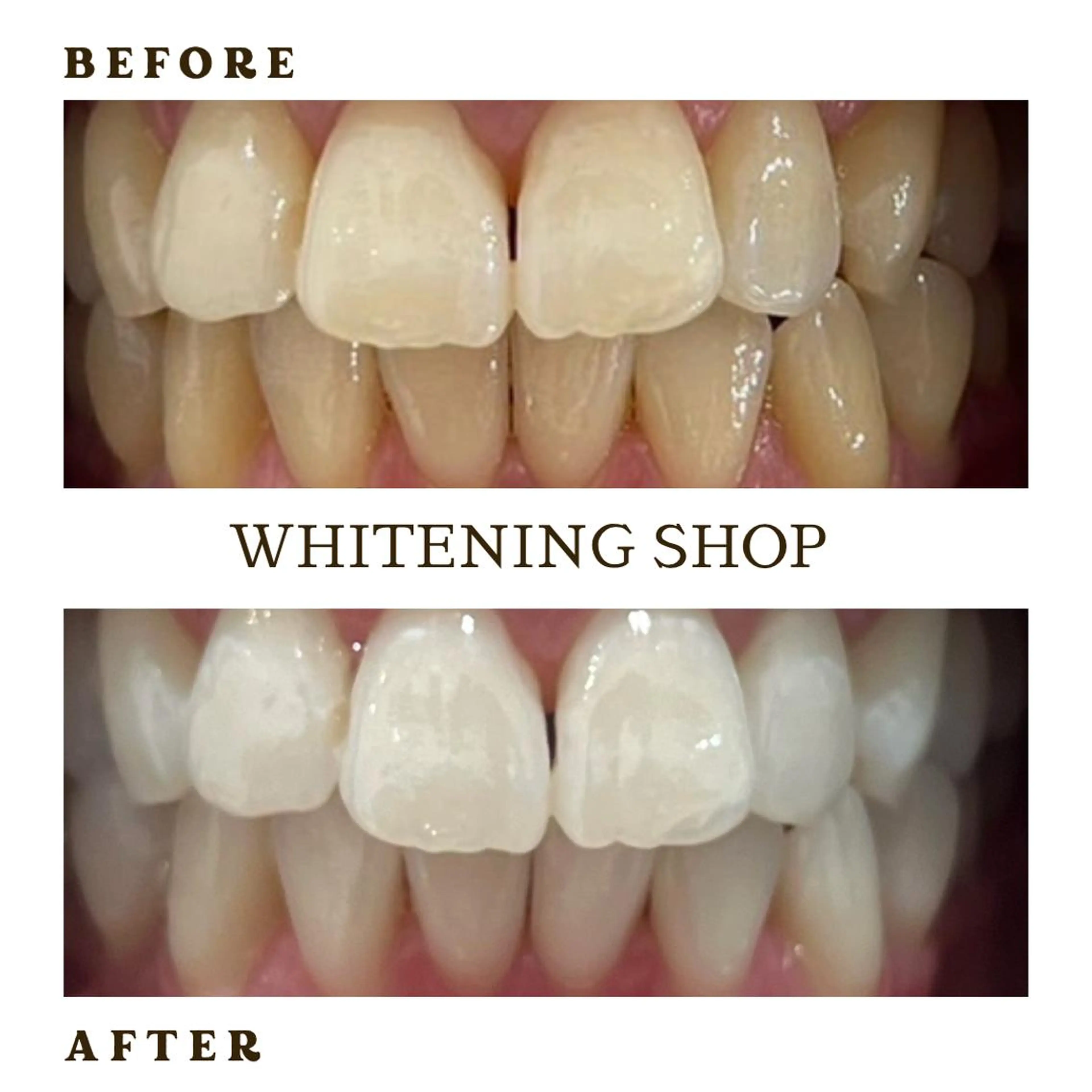 メンズ その他 ホワイトニング ショップ葛西店のその他イメージ