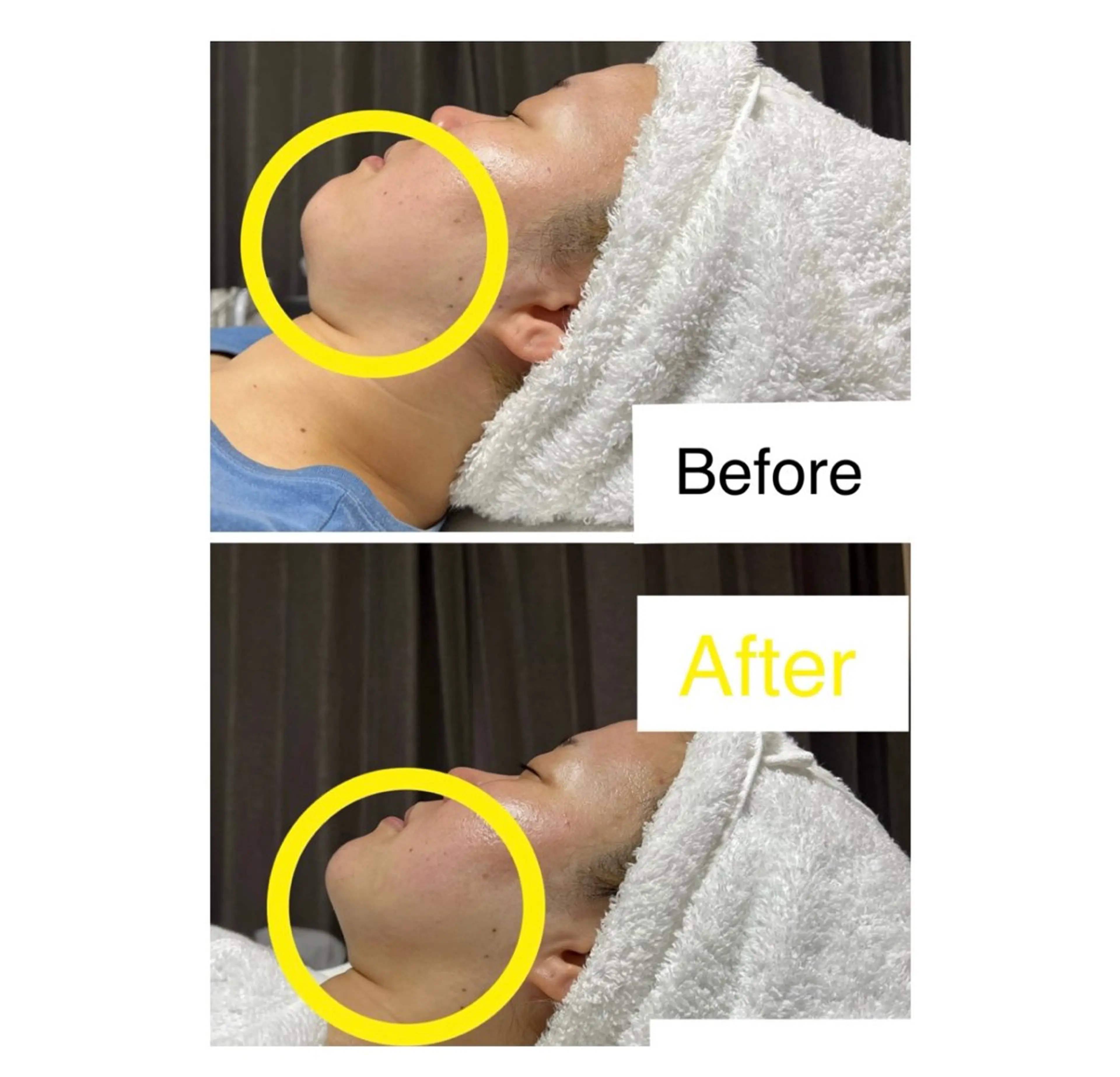 エステ ROR Akariのエステ・リラクイメージ