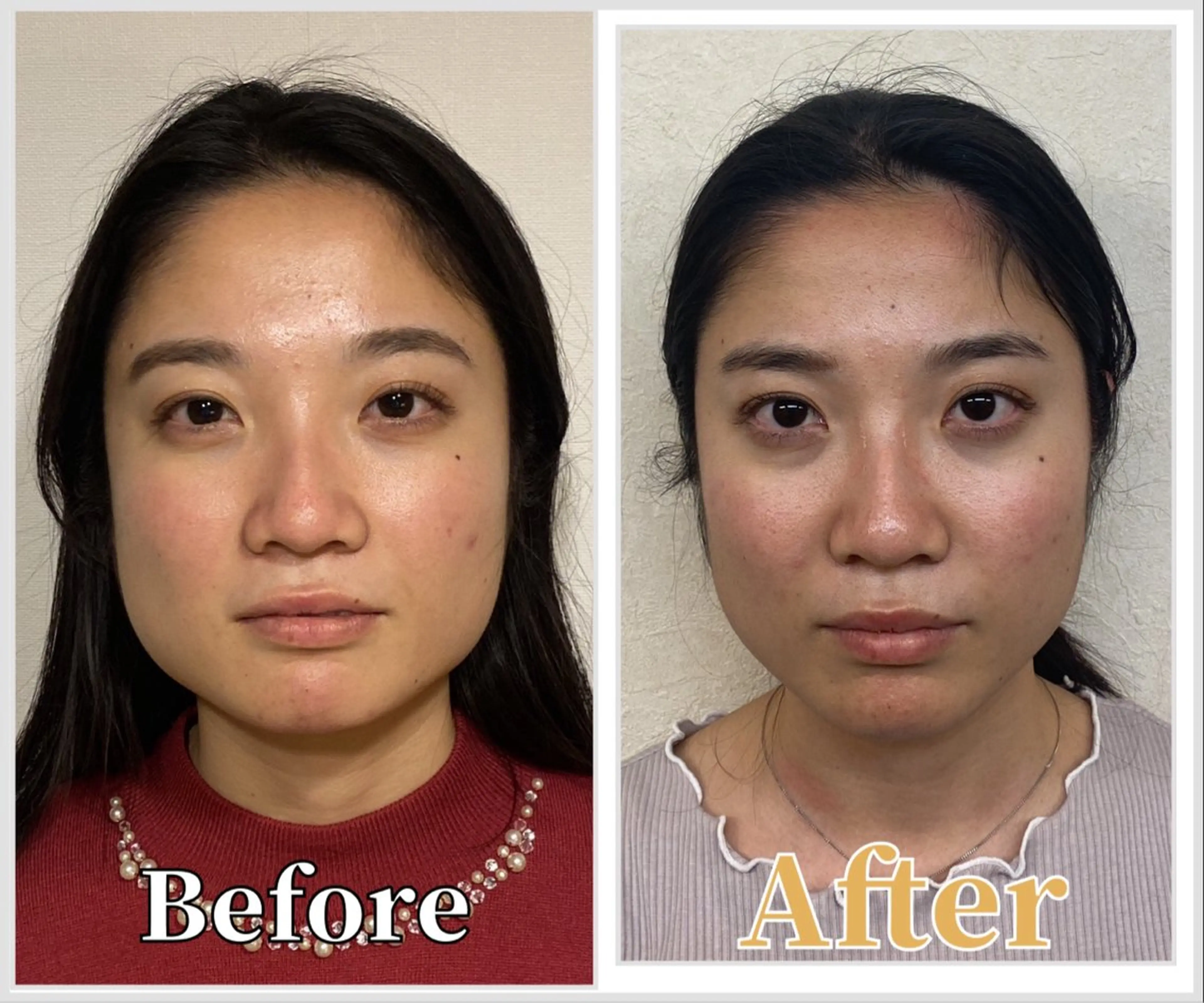 整体 LALUZ中目黒のその他イメージ