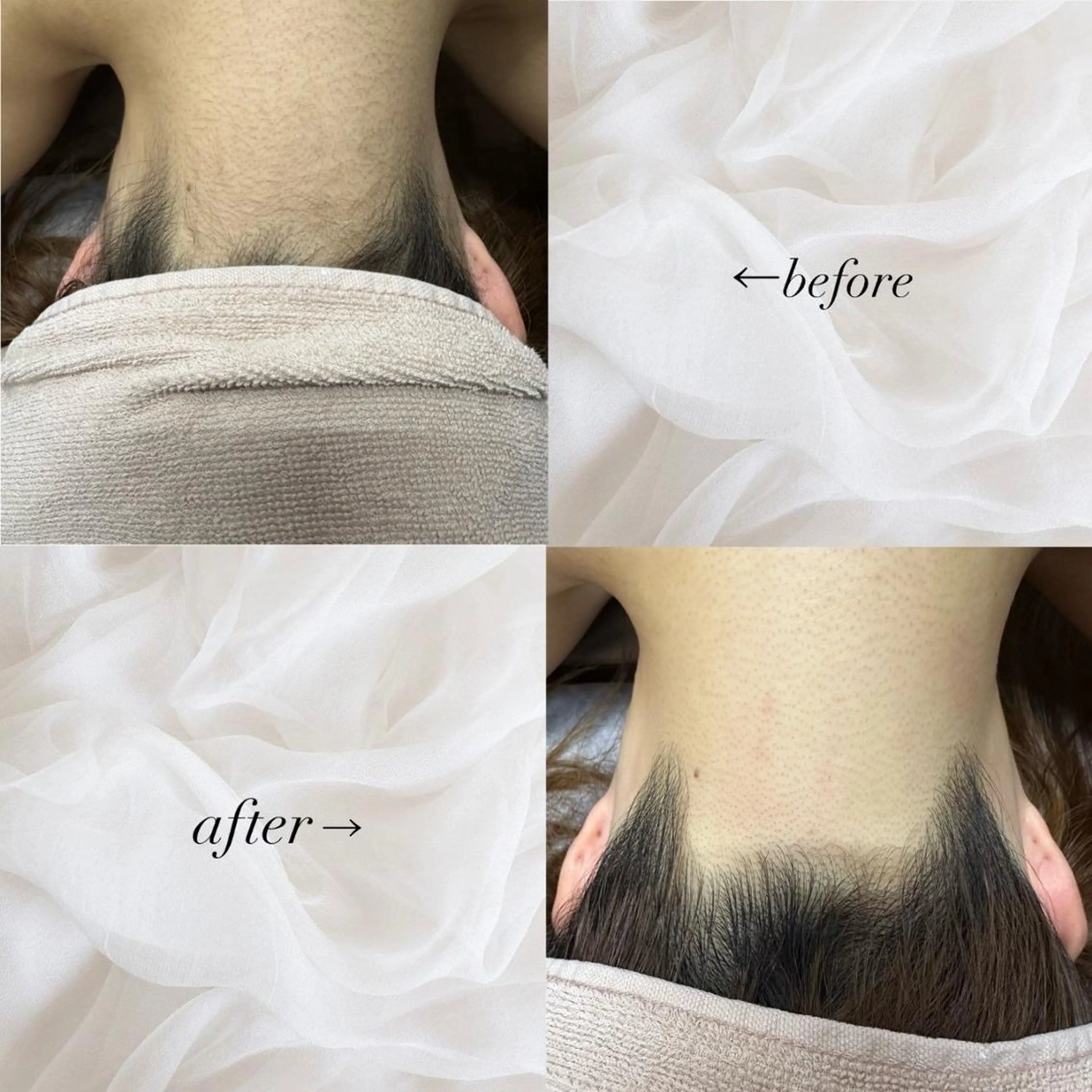 RinRin 豊田店のエステ・リラクイメージ