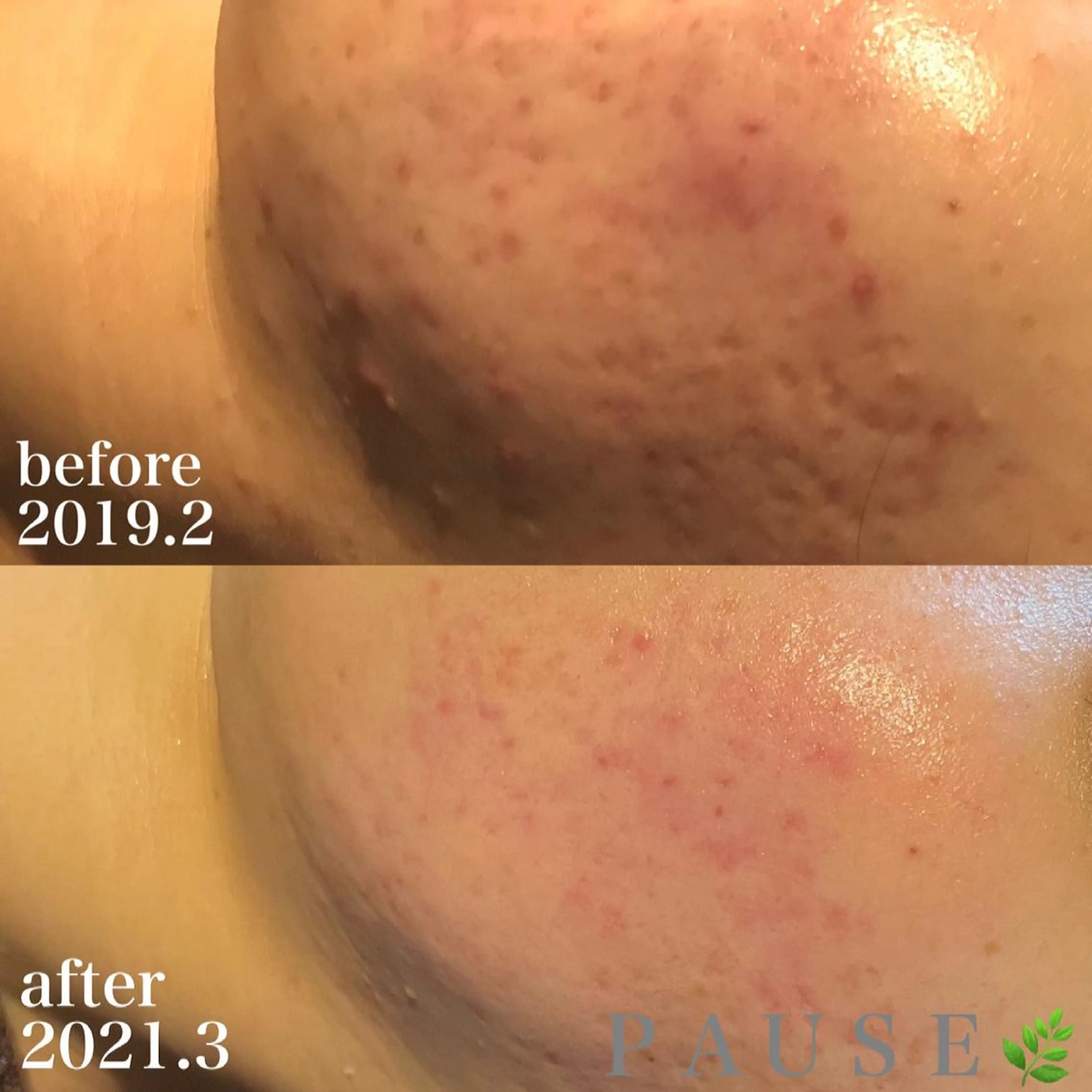 エステ リラク 浜野 恵美のエステ・リラクイメージ