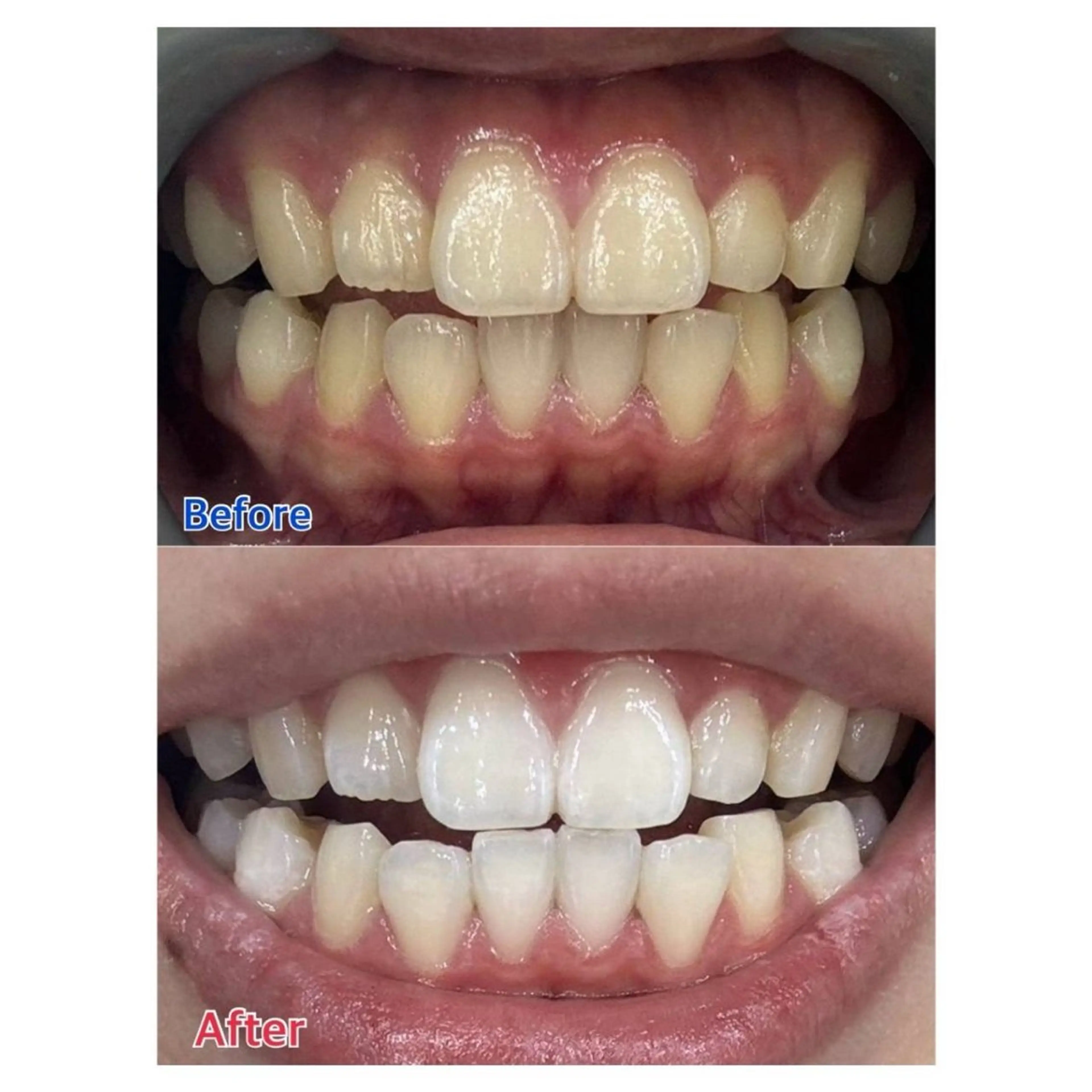 Melty 輝のその他イメージ