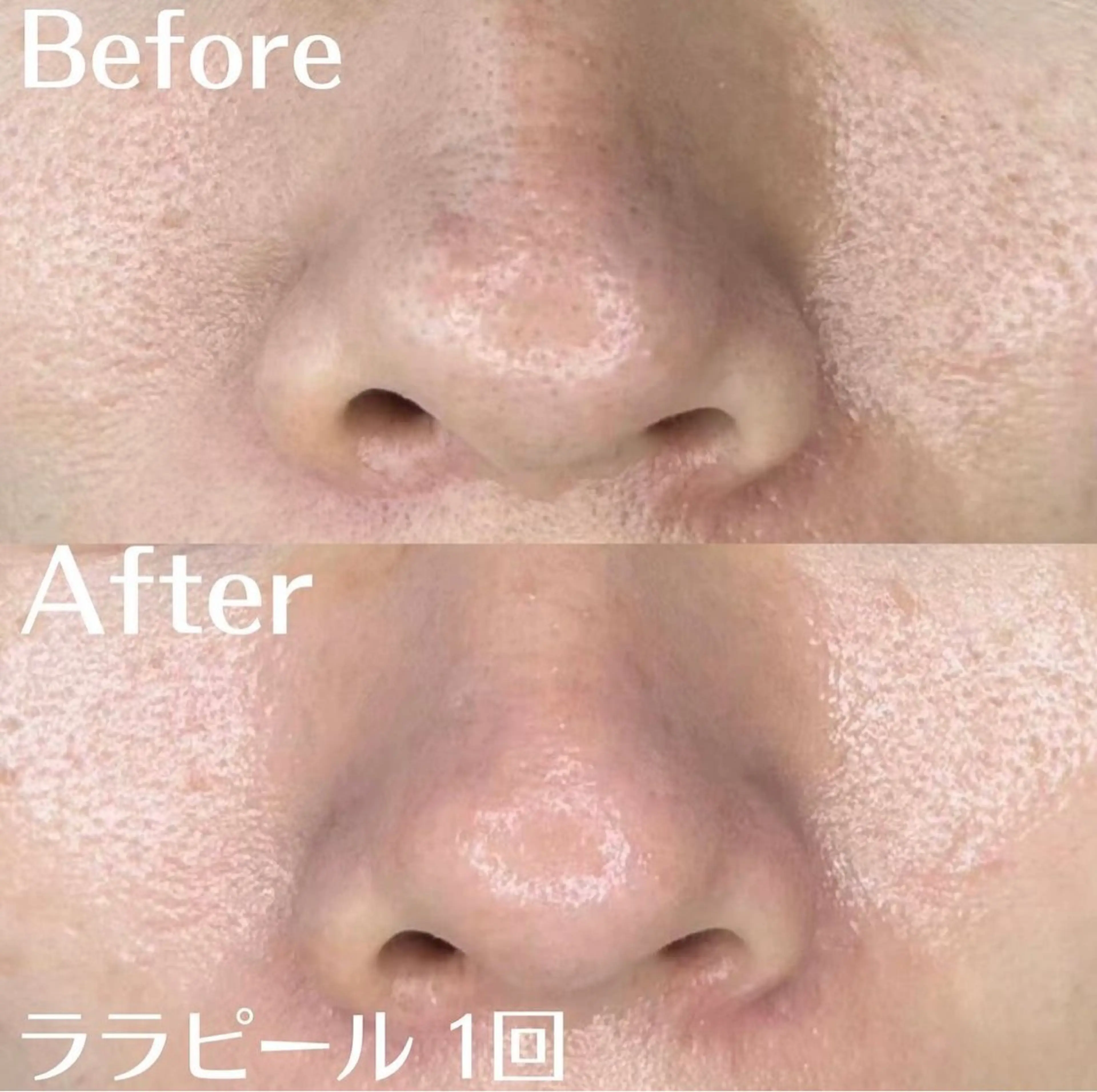 中目黒ハーブピーリン グ🌿ララピールのエステ・リラクイメージ