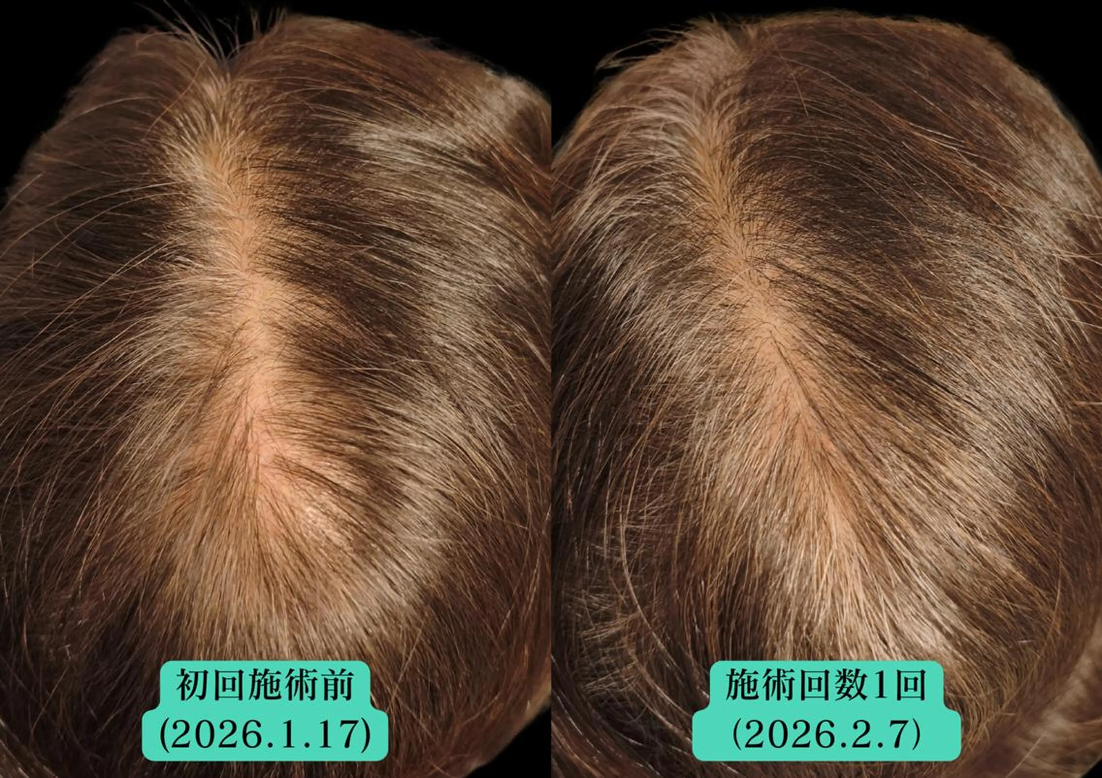 エステ リラク 美容とカラダの鍼灸 サロン やなけんのエステ・リラクイメージ