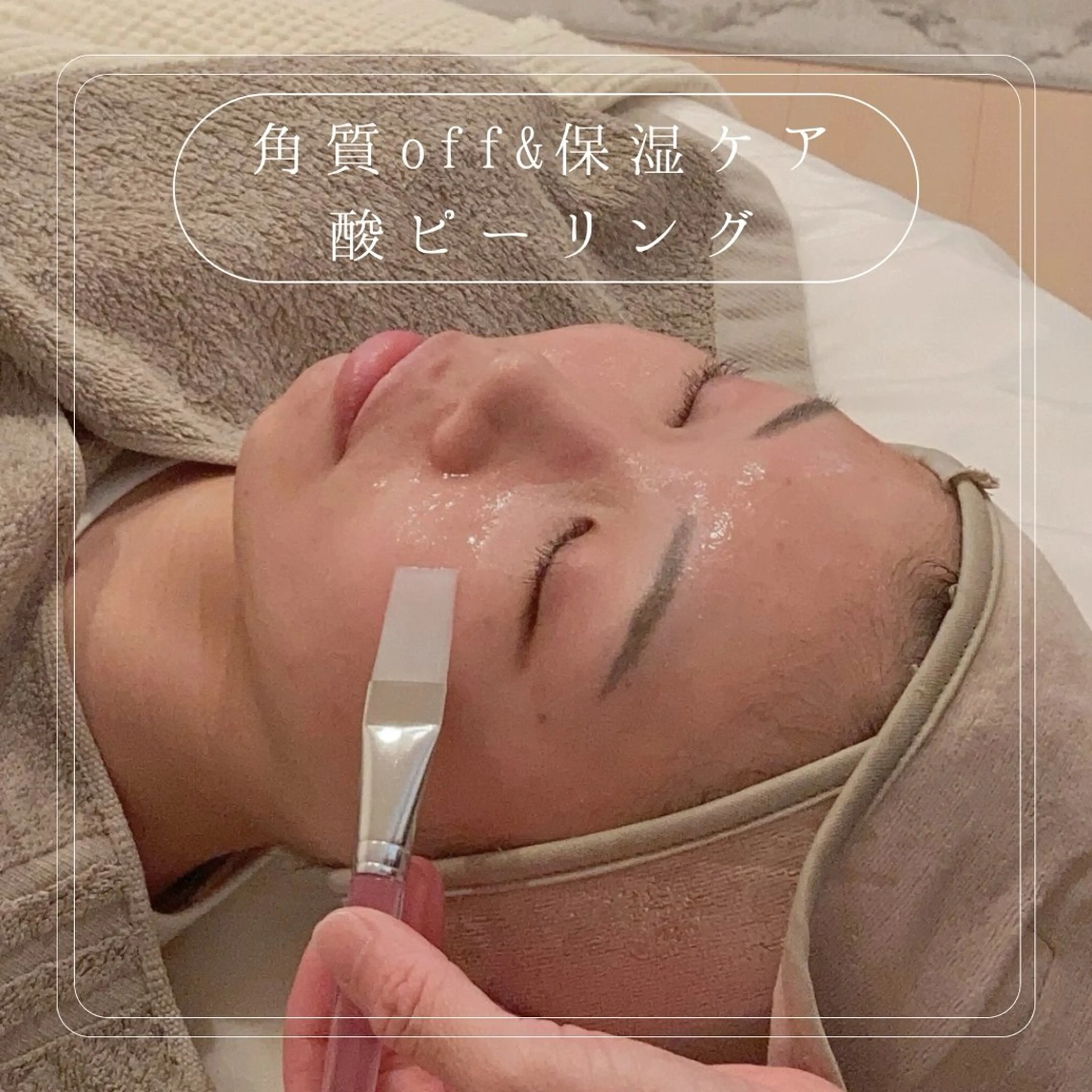 【酸ピーリング🌿】余分な角質をoff＆保湿ケア／酸の力で優しく角質をとることでごわつきoff❣️お手入れ効果がUP☝️の写真