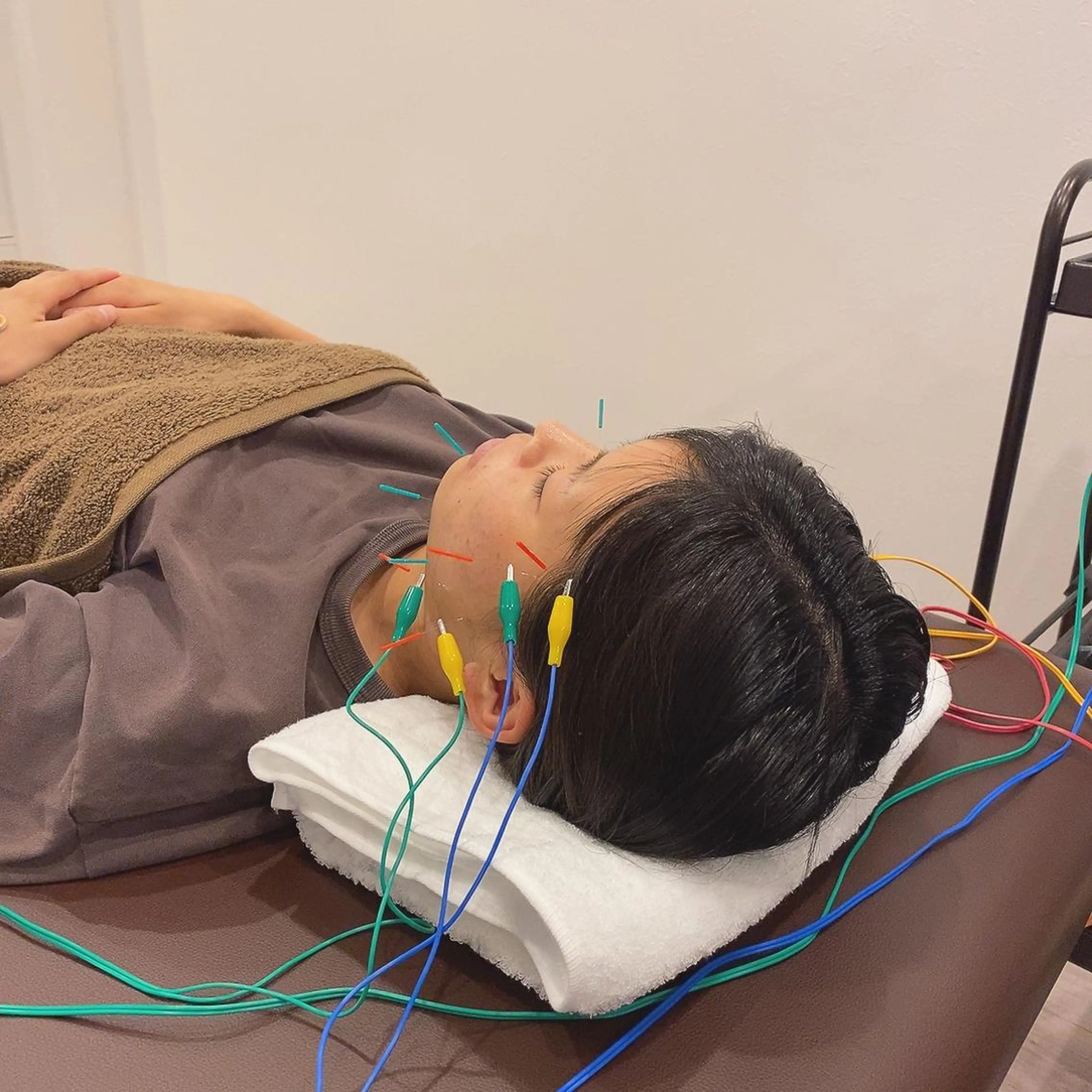 肌質改善×美容鍼 ゆいのエステ・リラクイメージ