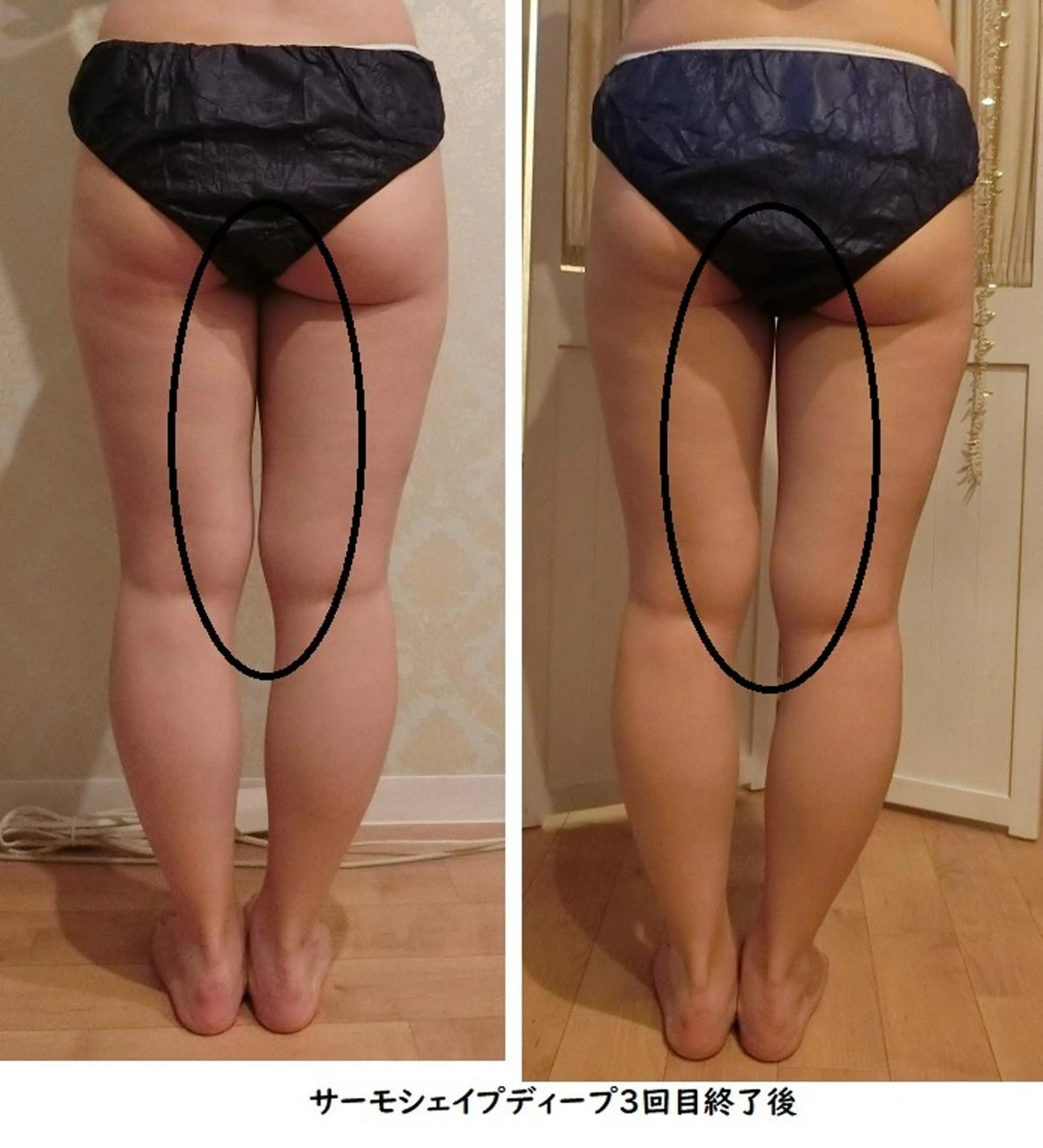 くびれ作り専門サロン こねこのシッポ虎ノ門のエステ・リラクイメージ