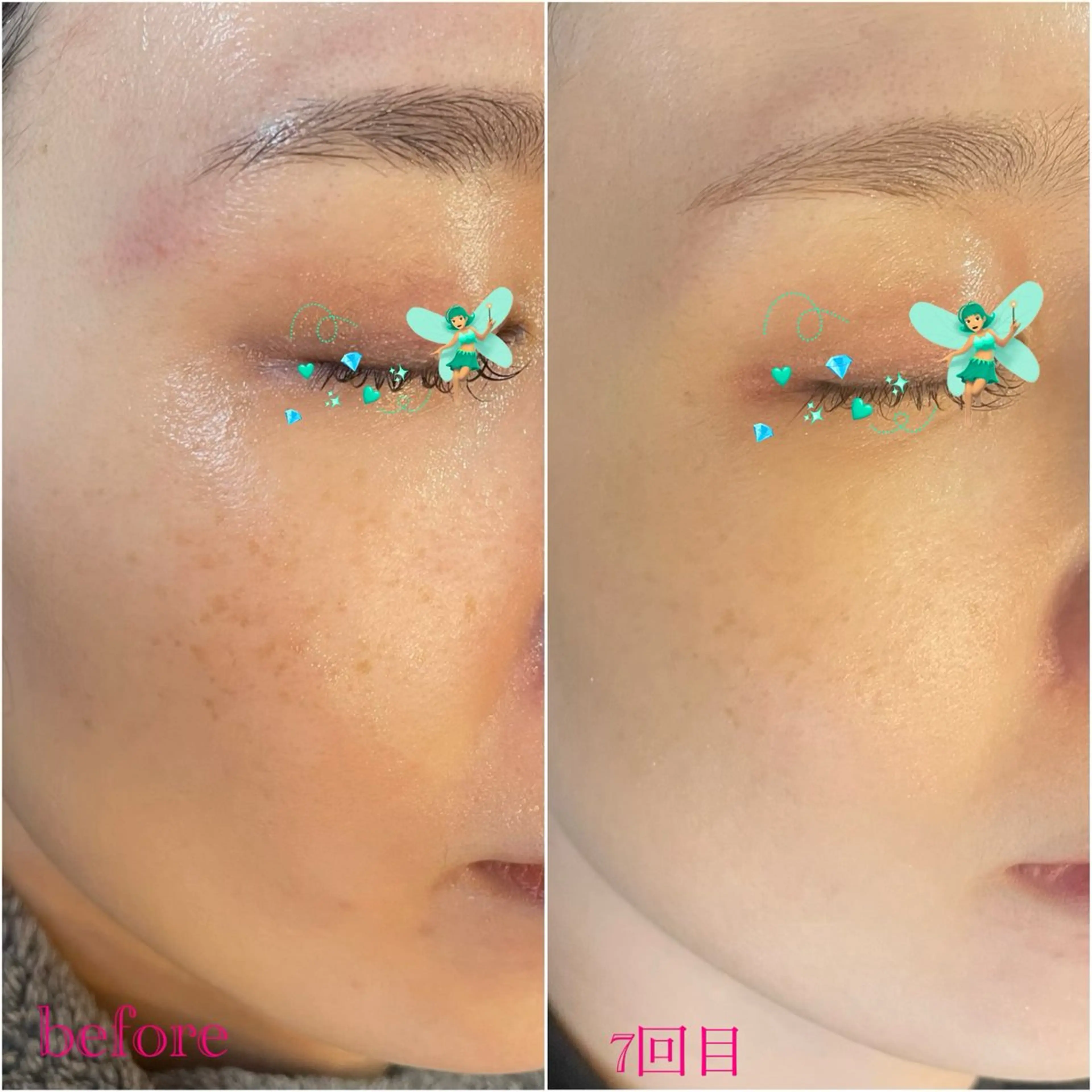 〚博多〛フィユ 水江のマツエク・マツパデザイン