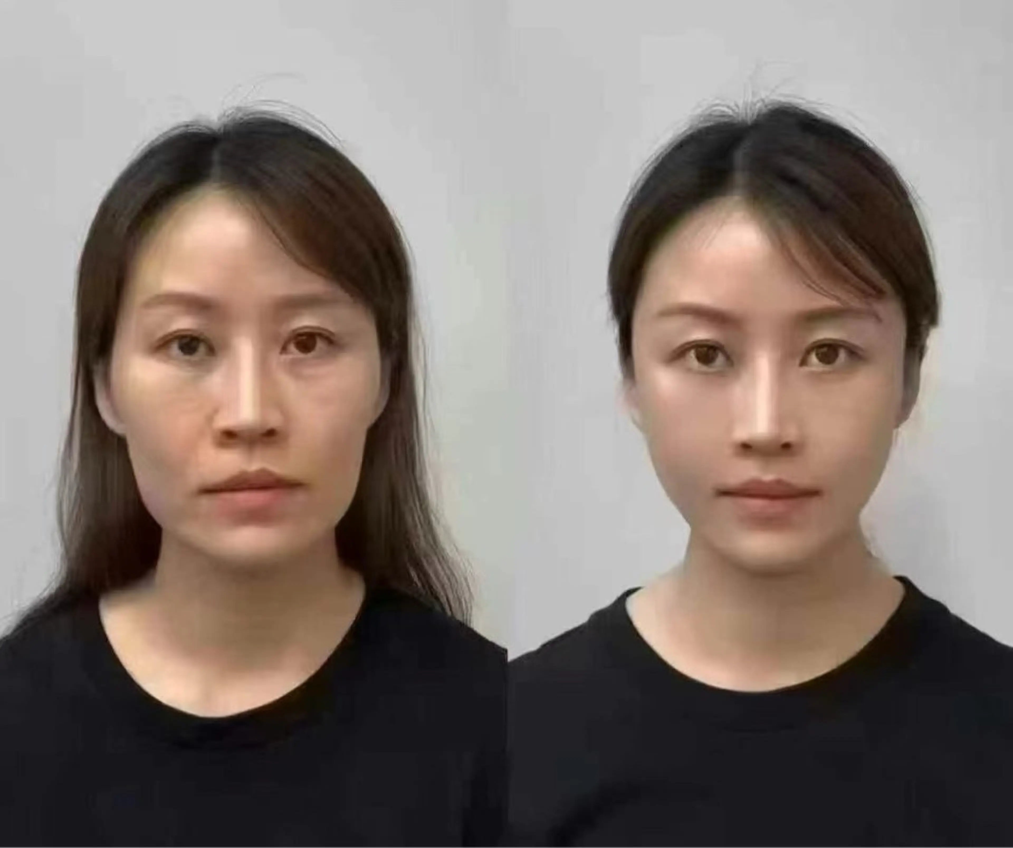 カラー エステ aliaハーブ水光店 エステティシャン募集のエステ・リラクイメージ