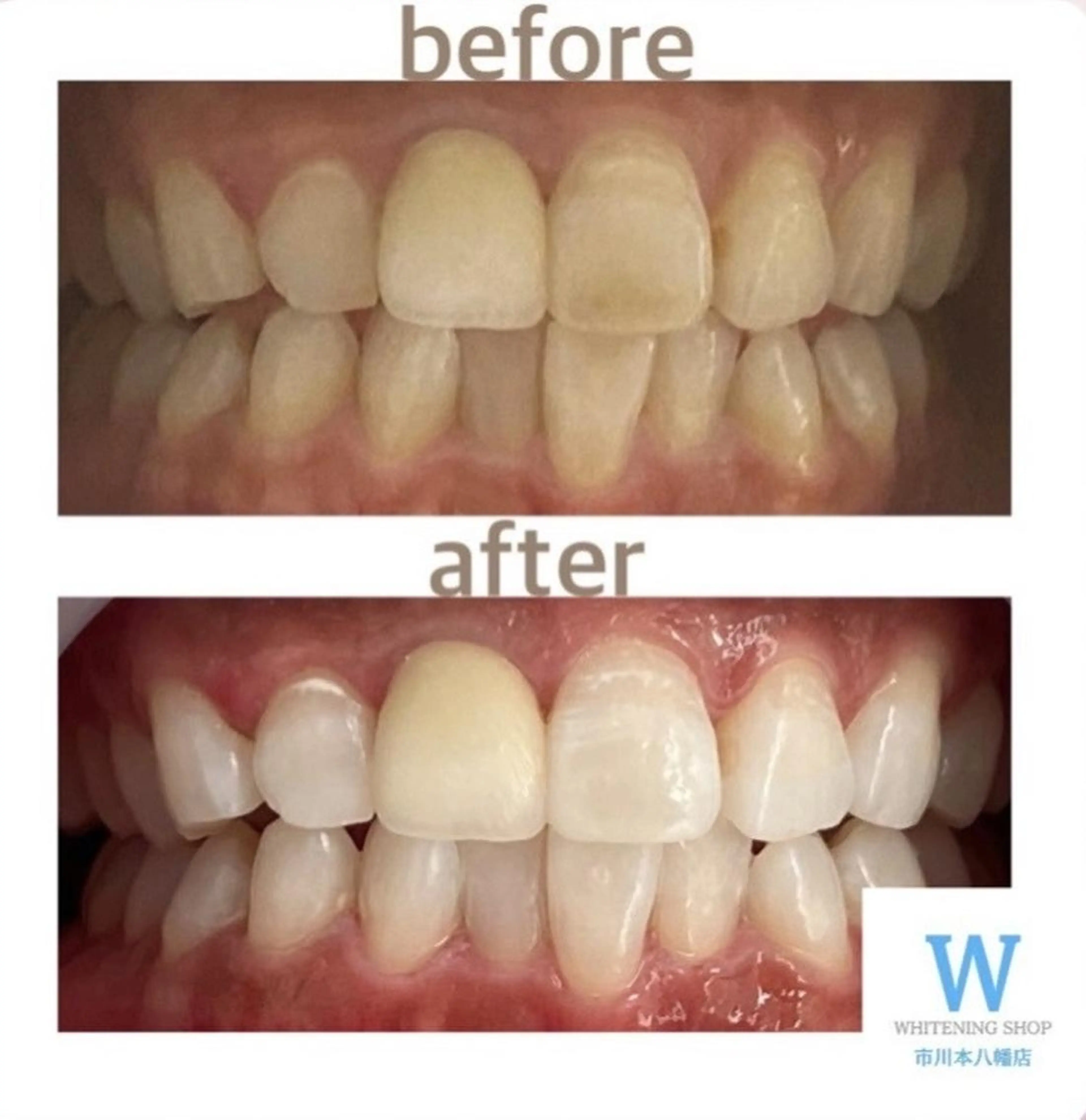 ホワイトニング ショップ本八幡店のエステ・リラクイメージ