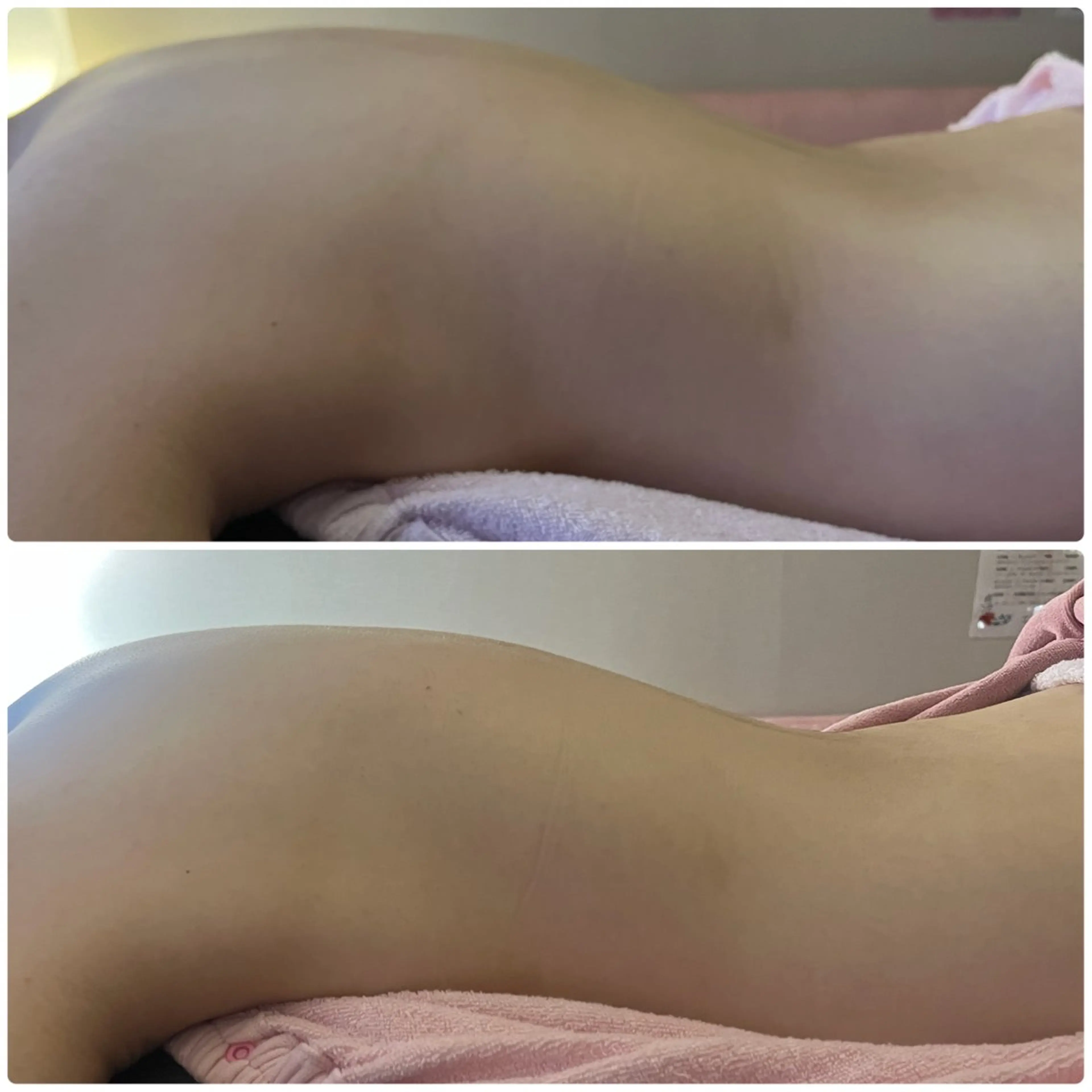 アロマ･美容鍼･カッ ピング「麗」鍼灸院のエステ・リラクイメージ