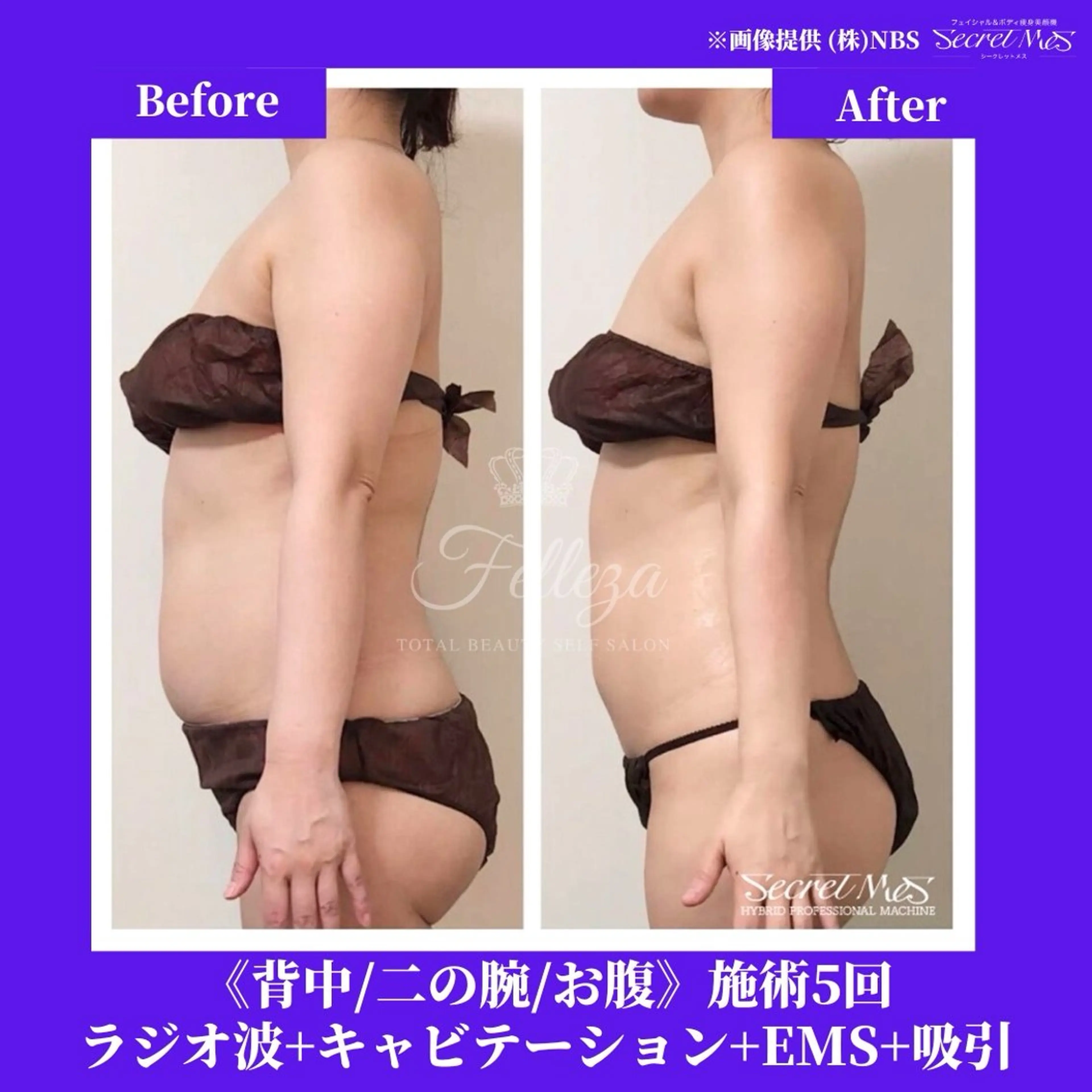 メンズ 有人型セルフサロン 脱毛／痩身／美顔のエステ・リラクイメージ