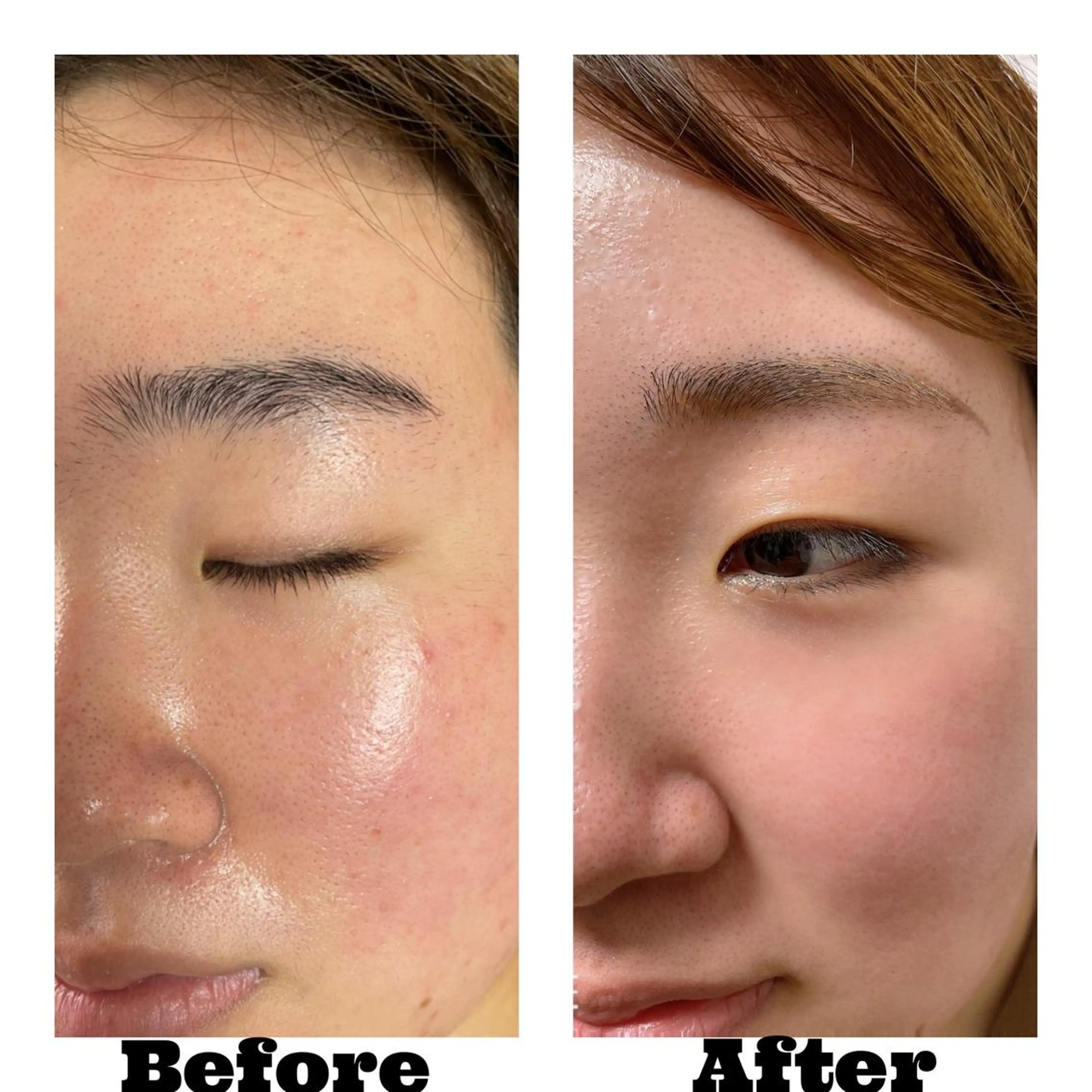 アイブロウ Linomalie エステ/たるみ/脱毛のエステ・リラクイメージ