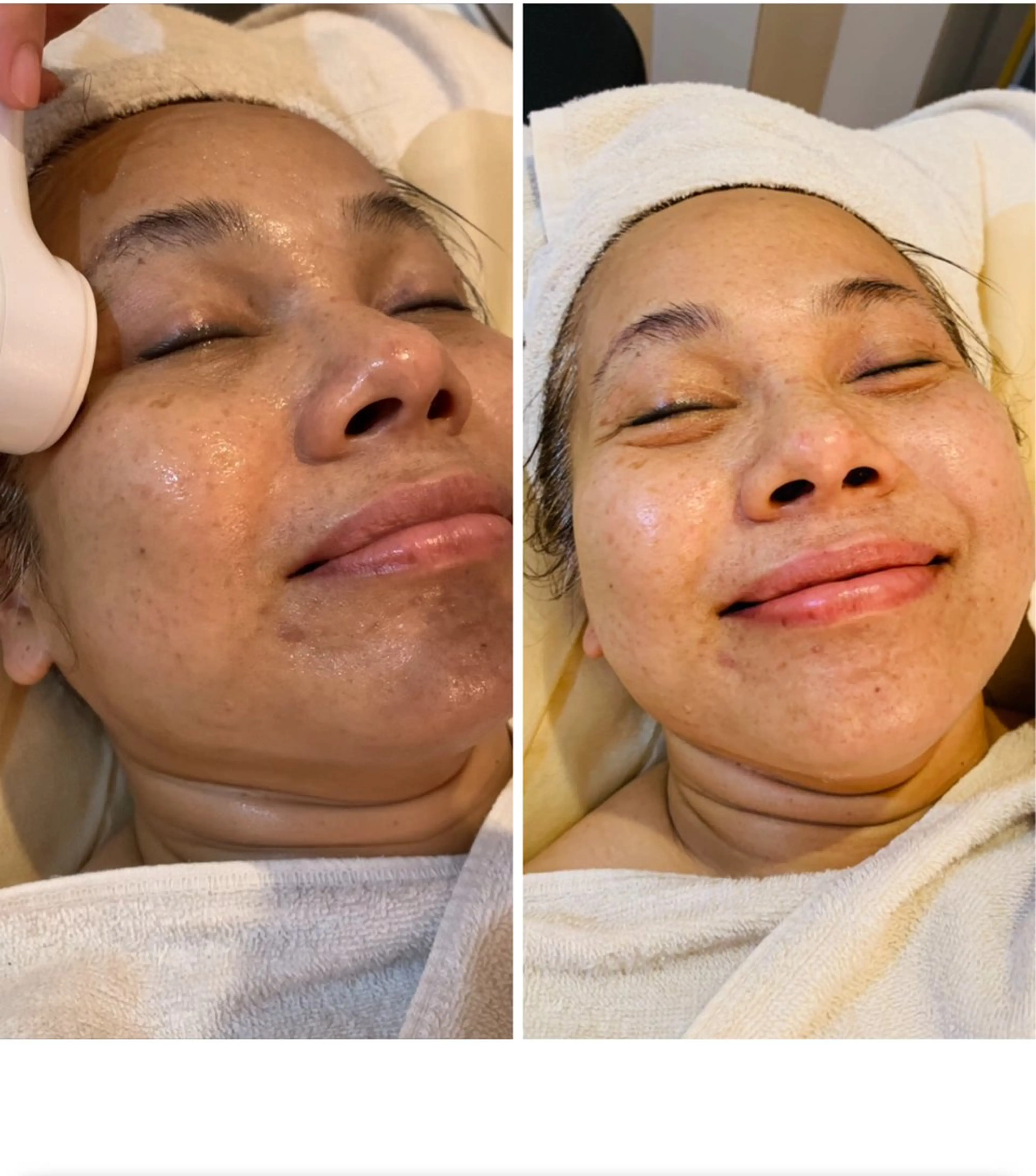 エステ 平塚店⭐️美肌サロン 🌱リンパマッサージのエステ・リラクイメージ