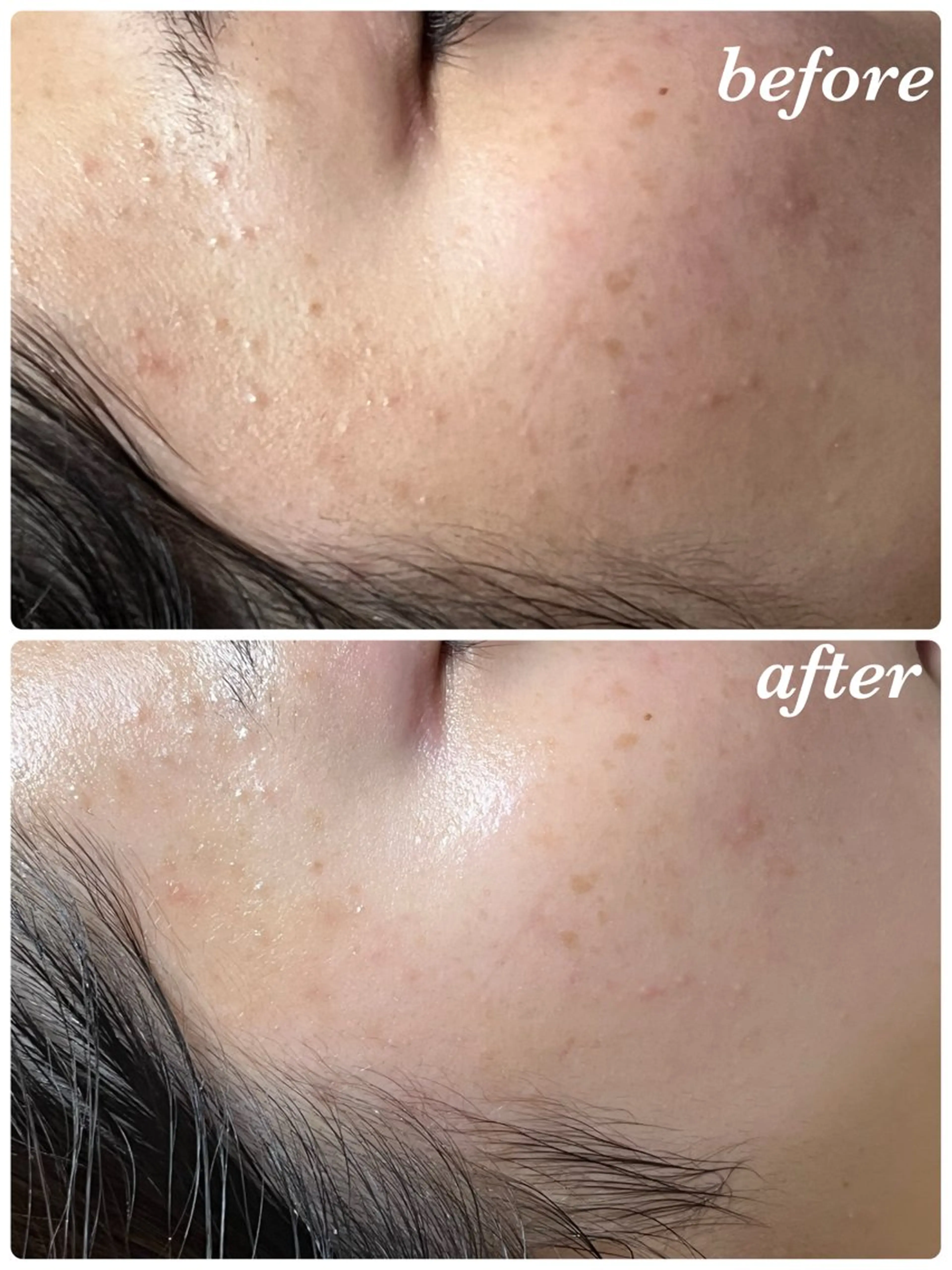 エステ リラク 結果重視｜毛穴エステ ｜友綱理恵のエステ・リラクイメージ