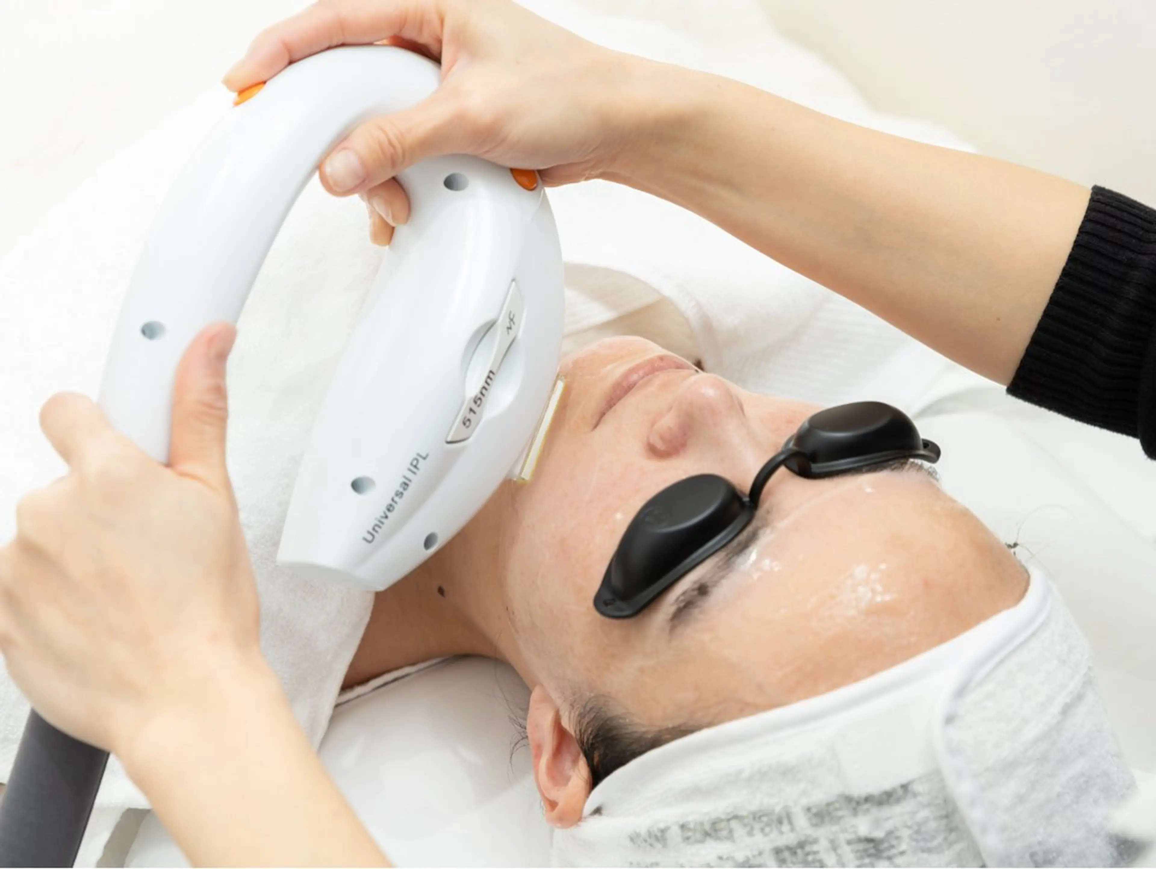 【赤み・シミ改善・ニキビケア】光フェイシャルの写真