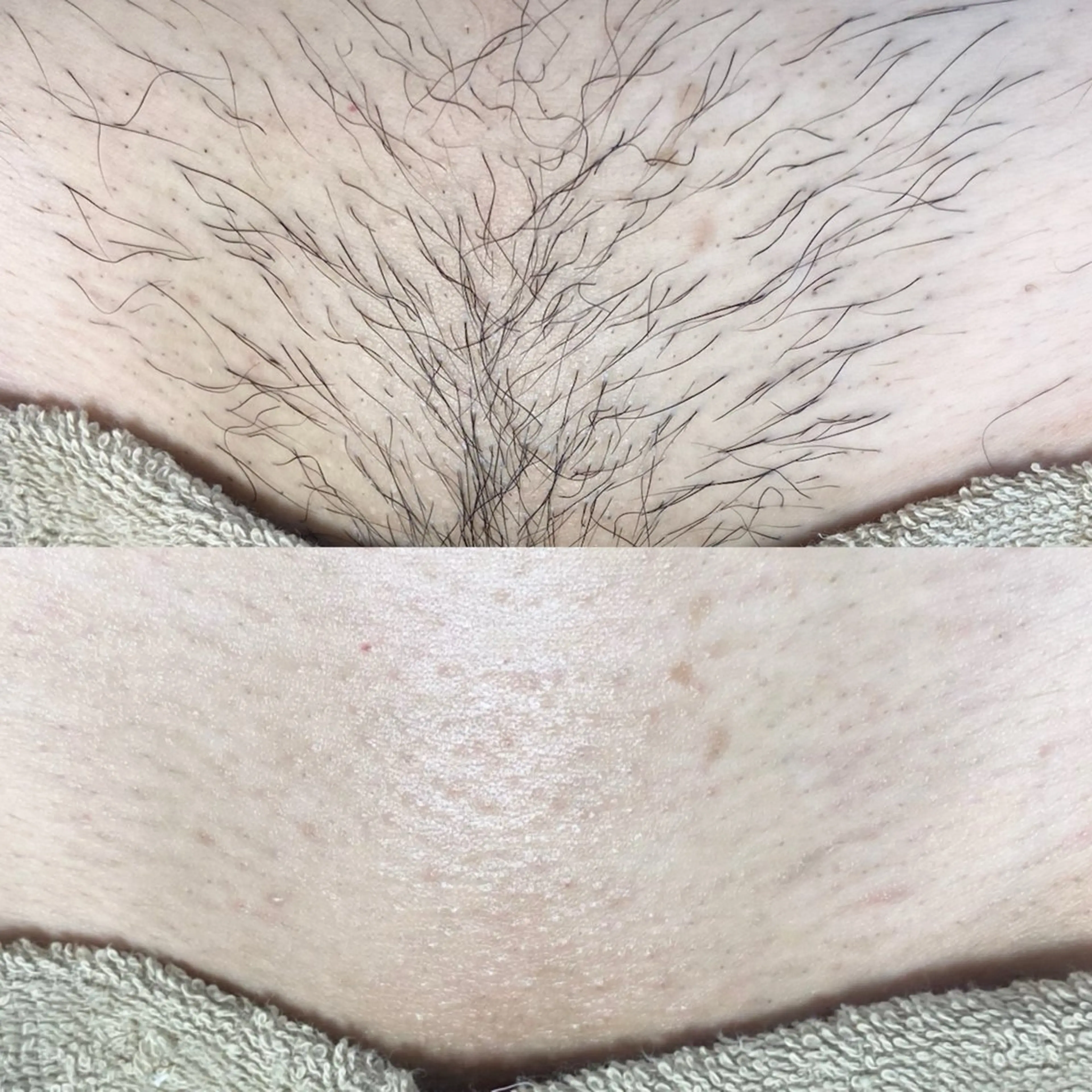 脱毛 &me ayakaのエステ・リラクイメージ