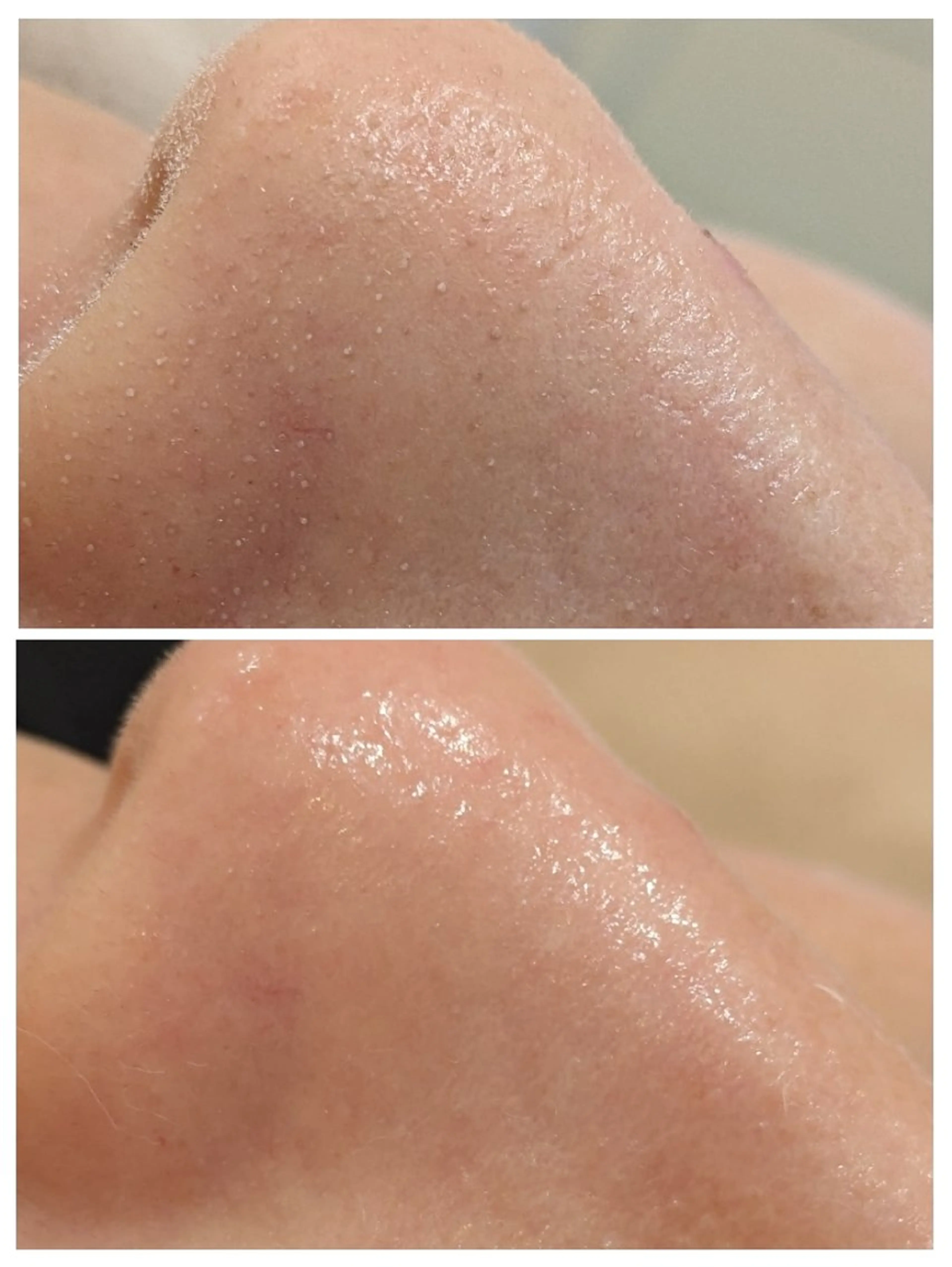 babyaiai 　momo🍑のエステ・リラクイメージ