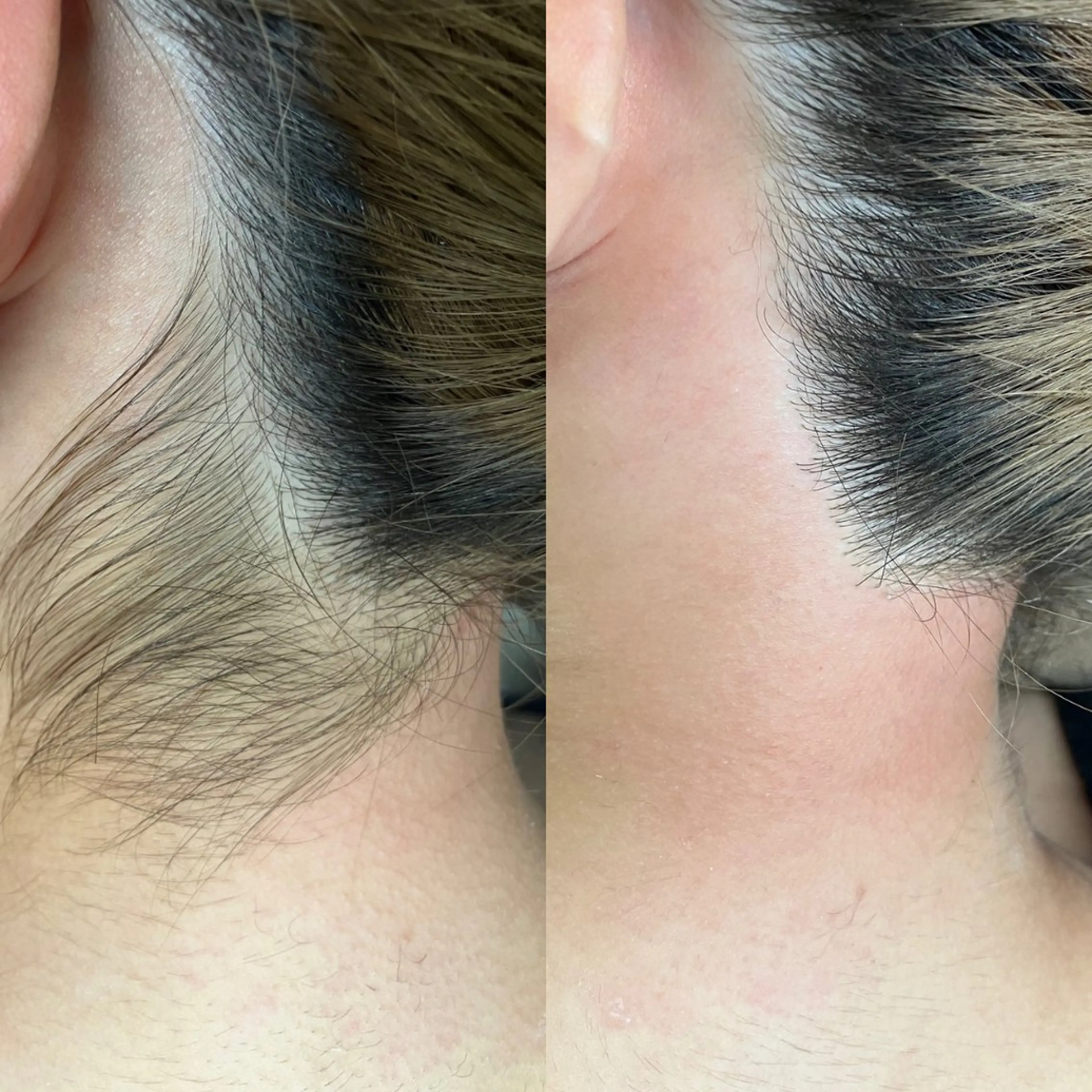 お顔を美しく魅せる 眉毛専門店ディアリーの眉毛・アイブロウイメージ