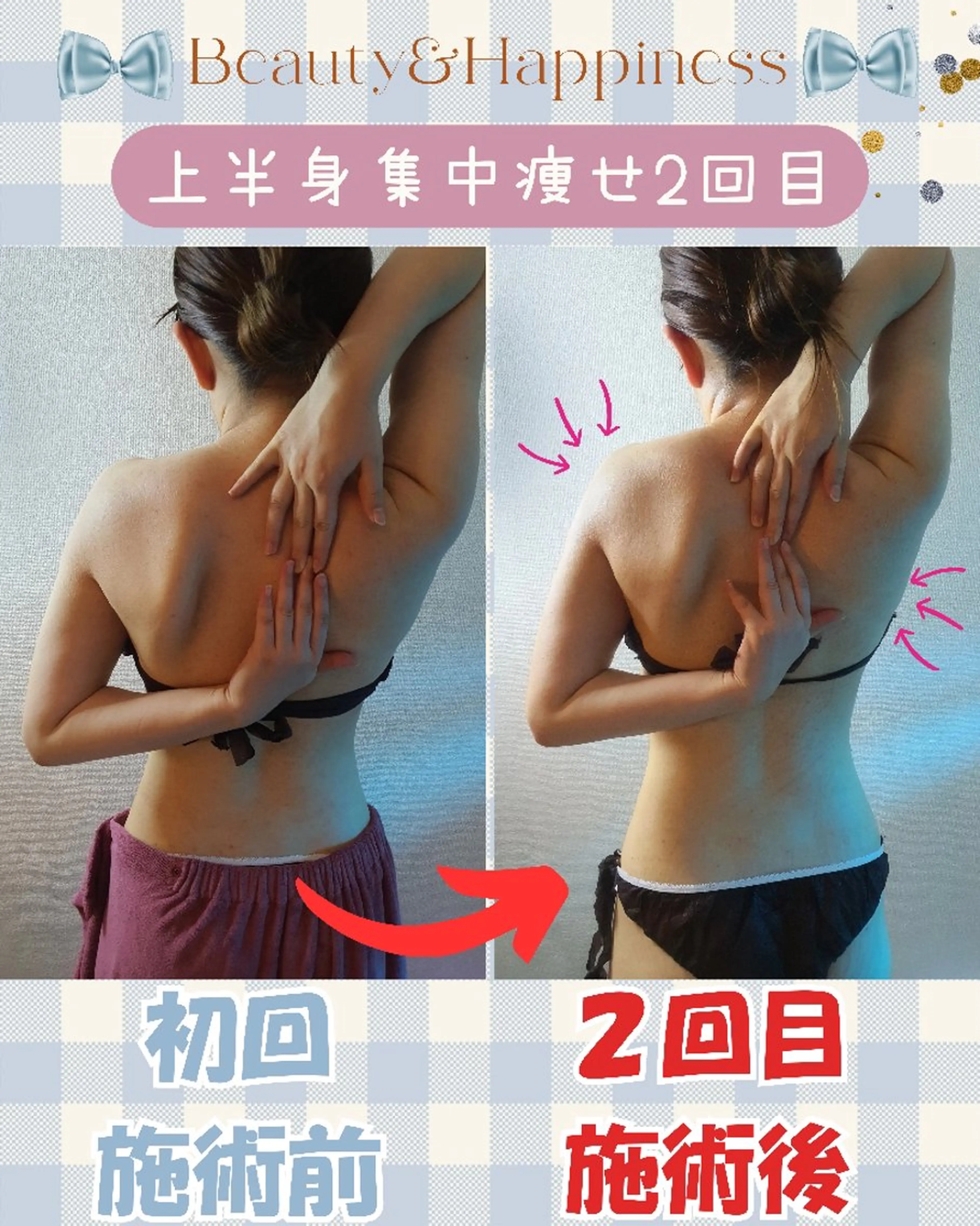 エステ リラク 痩身ハーブピーリング 筋膜リリース☆B&Hのエステ・リラクイメージ