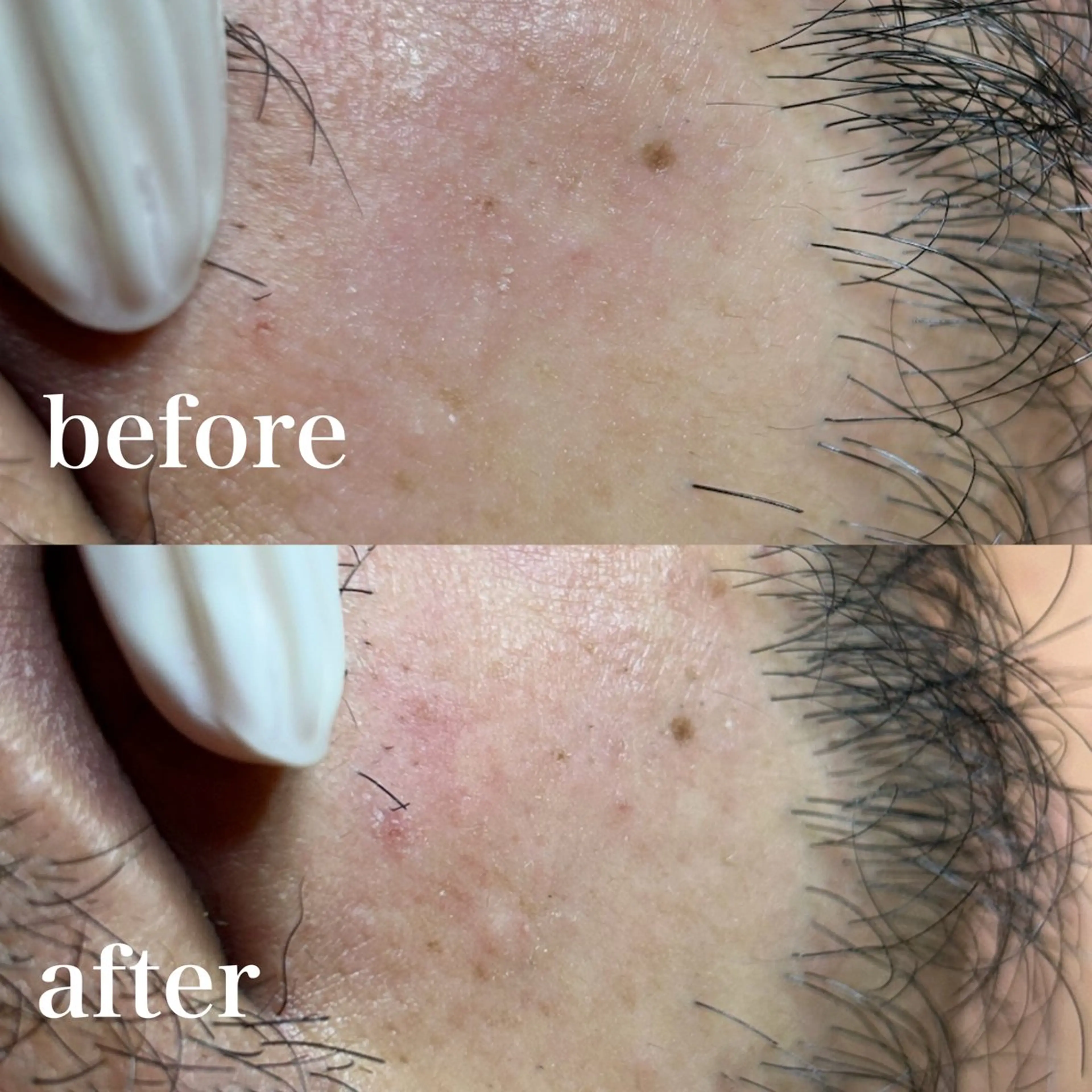 美肌脱毛&毛穴専門 Nico🐰ྀི♡のエステ・リラクイメージ