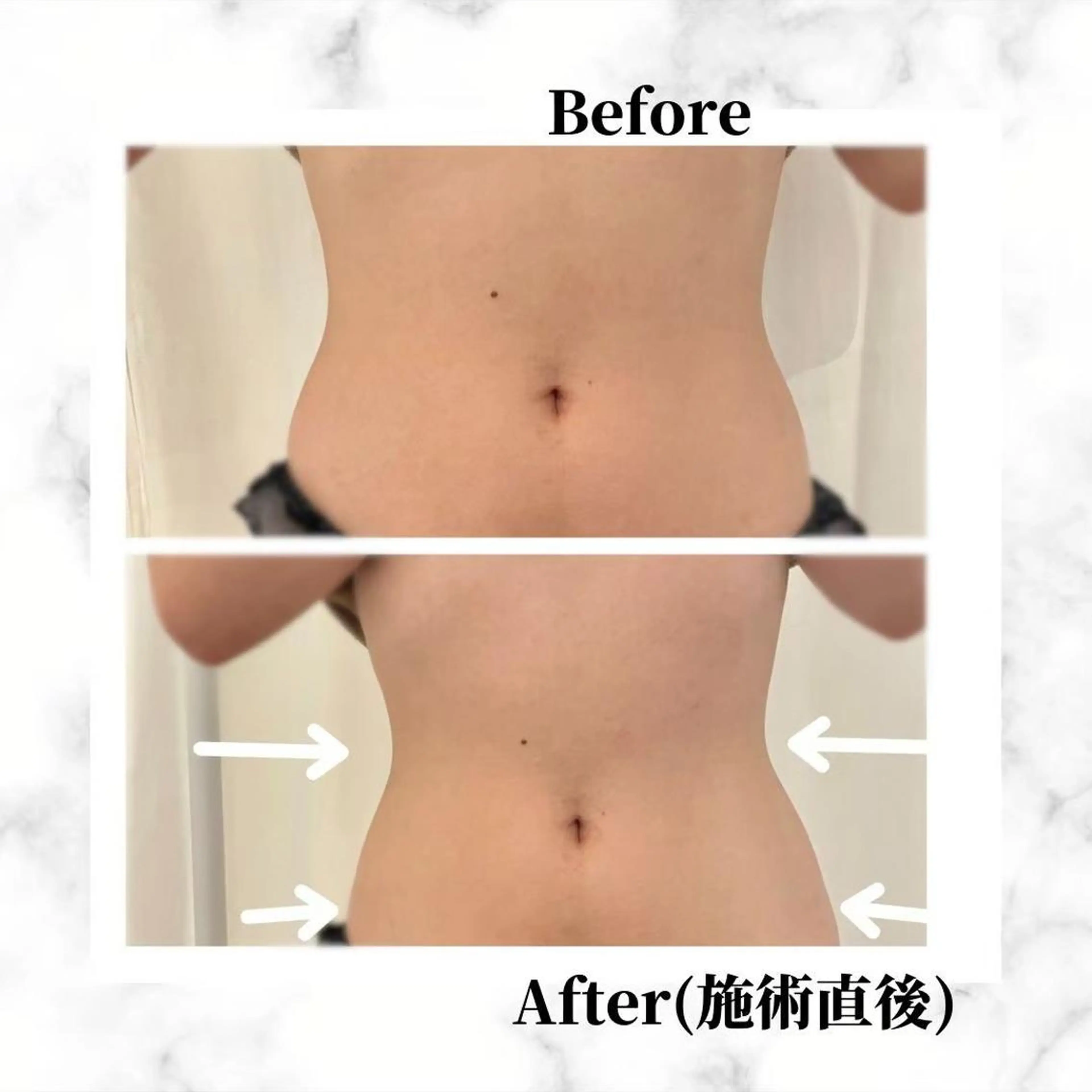 12Dハイフ💗 最強小顔のエステ・リラクイメージ