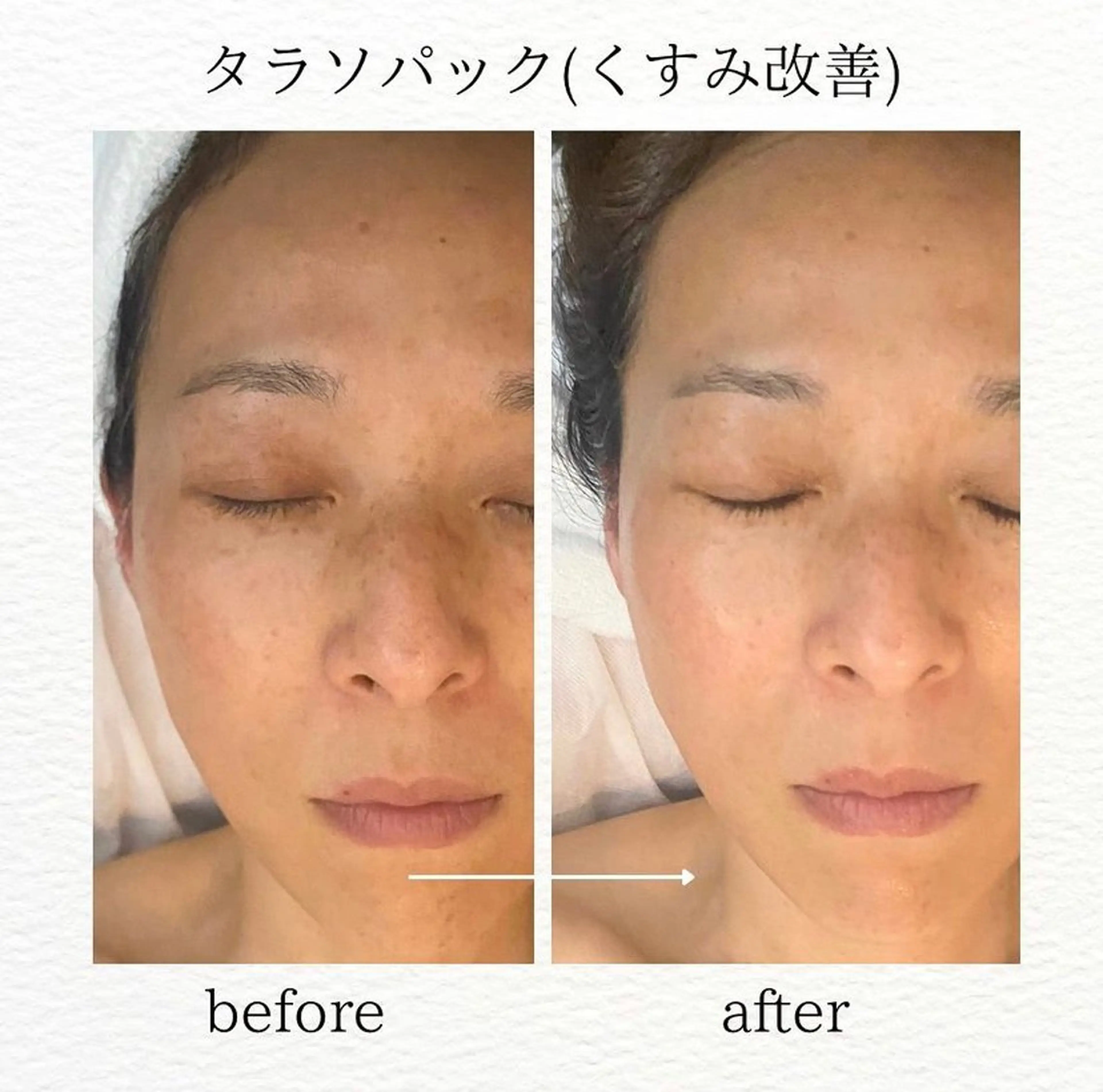 肌育成サロン ♡ RISAのエステ・リラクイメージ