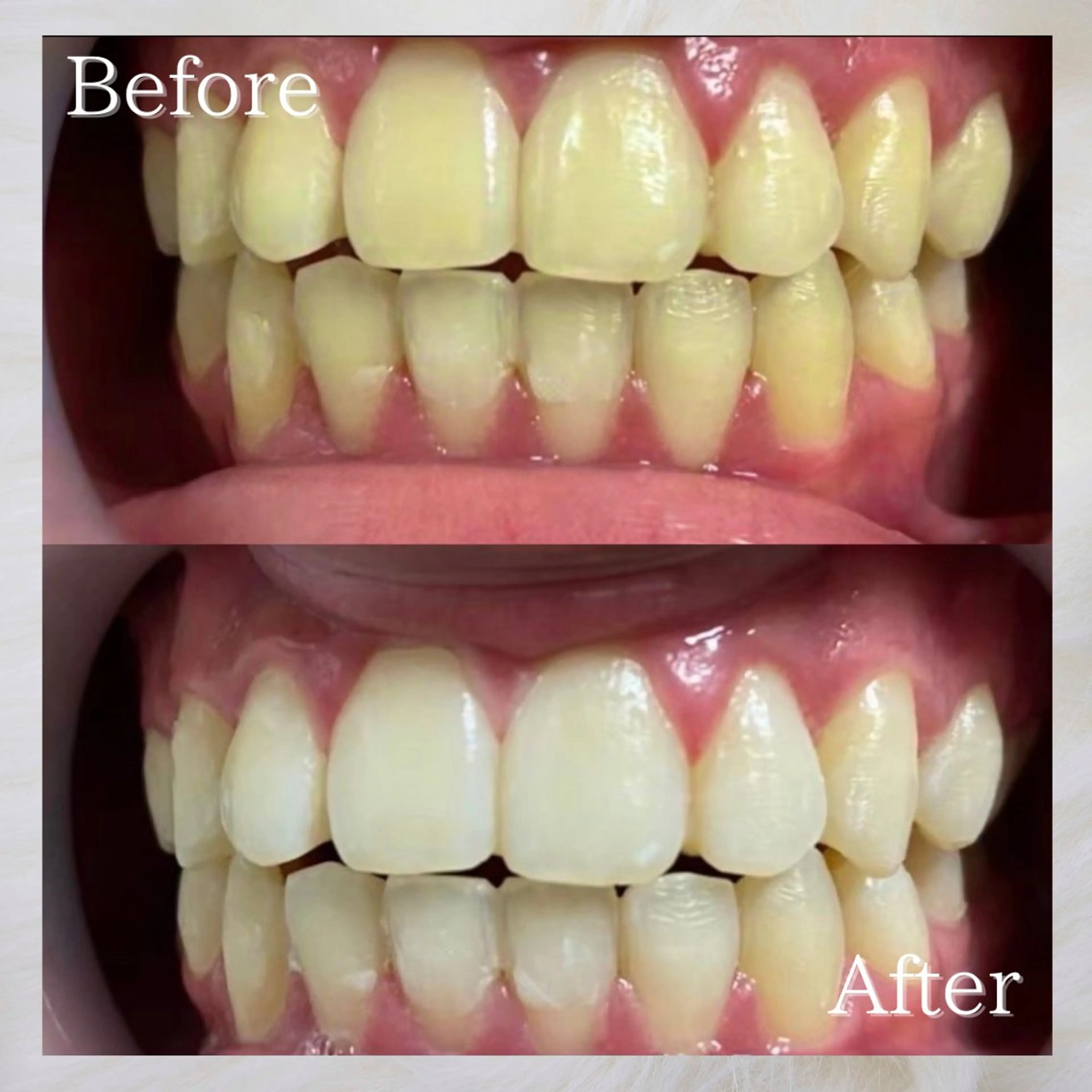 LBSホワイトニング 🌐岡山店のその他イメージ