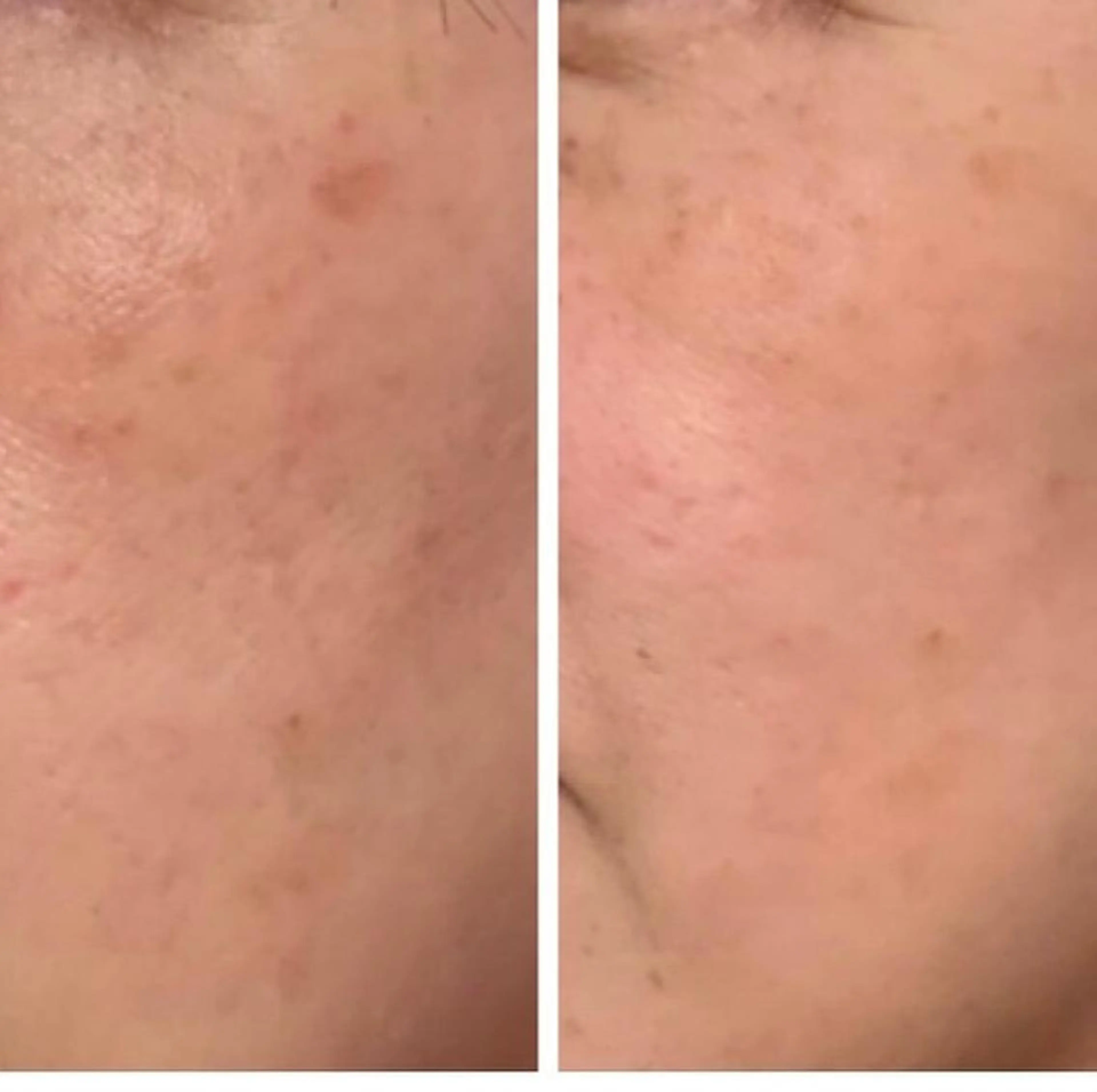 ドリームストリーム アイリストのエステ・リラクイメージ