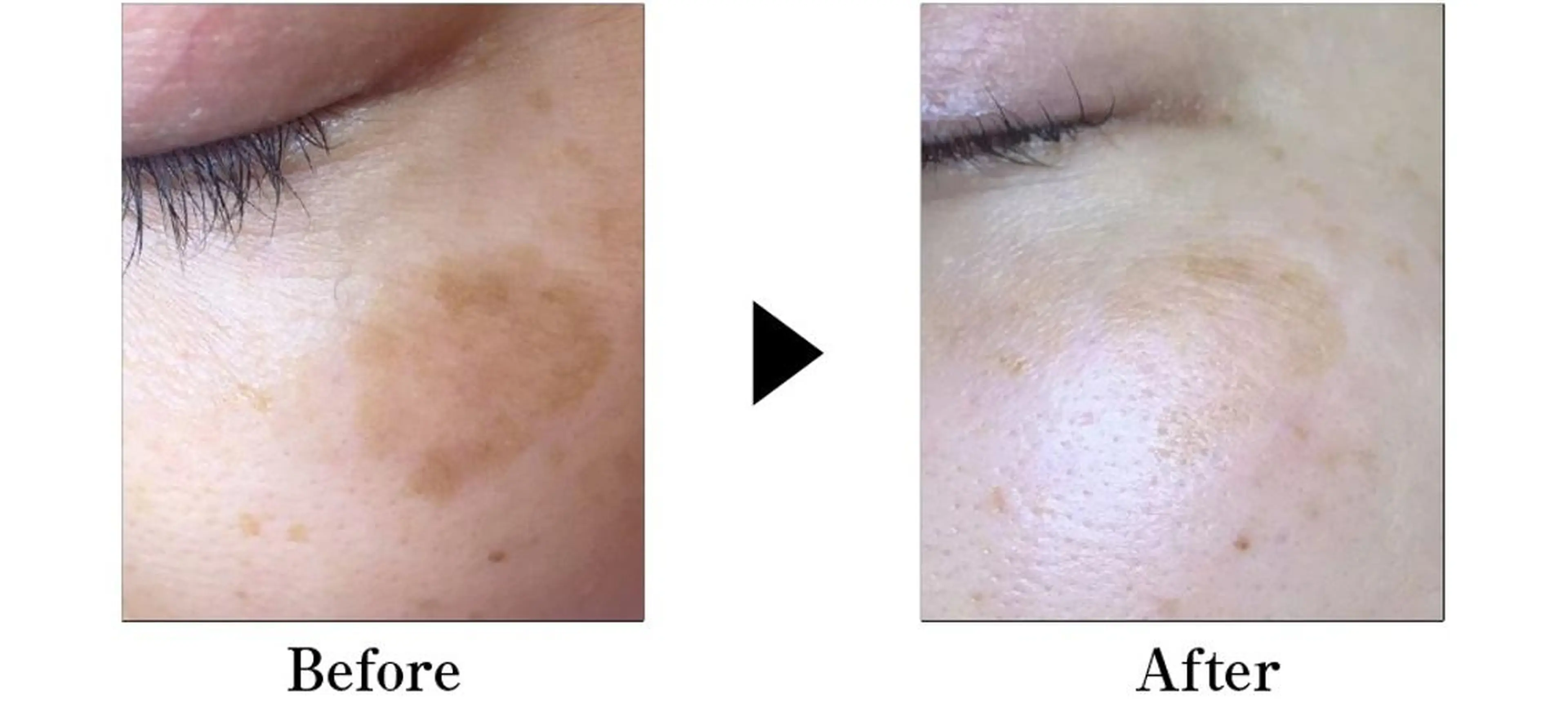 マツエク・マツパ ヘアアレンジ ロング キッズ メンズ ネイル 次世代まつげパーマは 『リベル名古屋』のマツエク・マツパデザイン