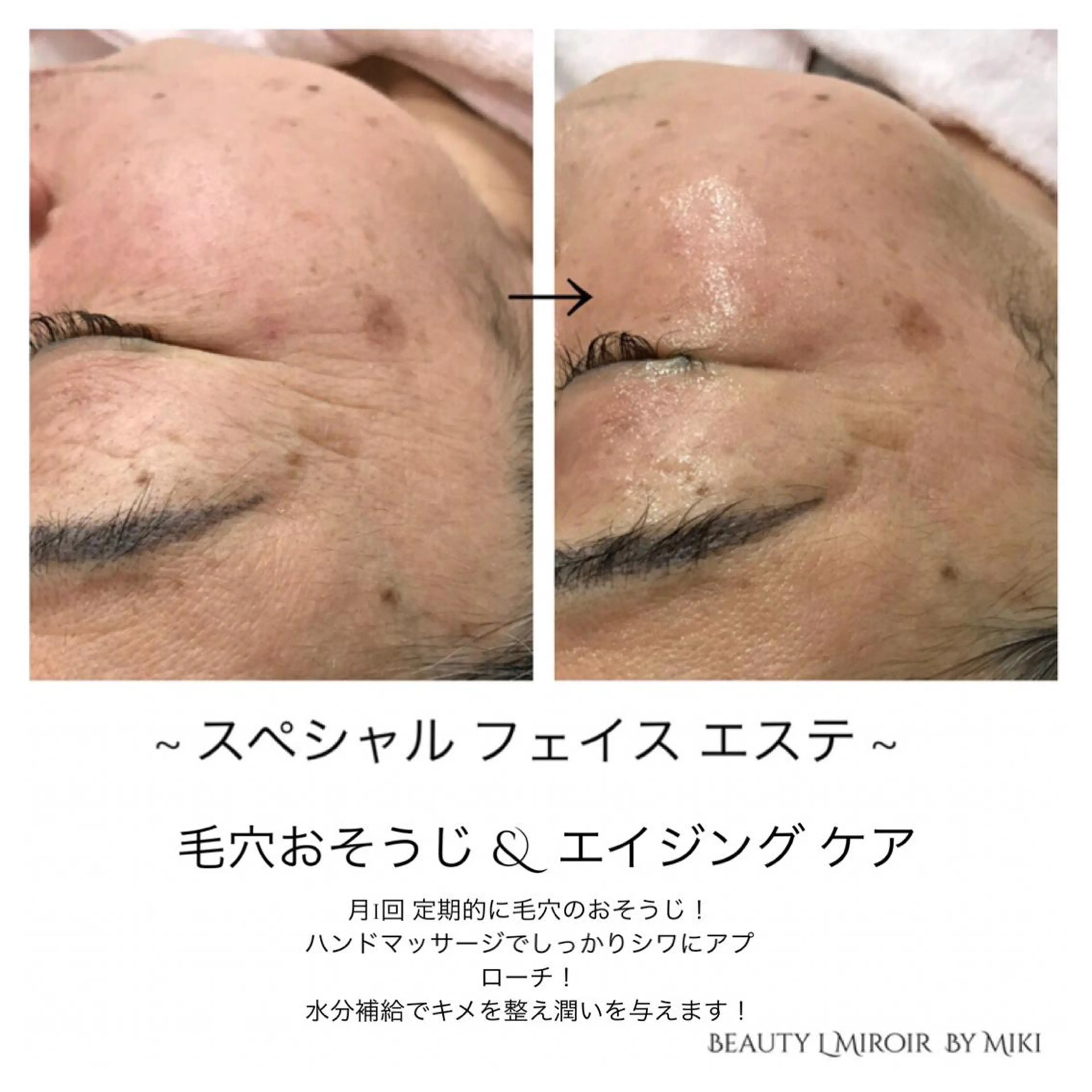 ビューティー ミロワールのエステ・リラクイメージ