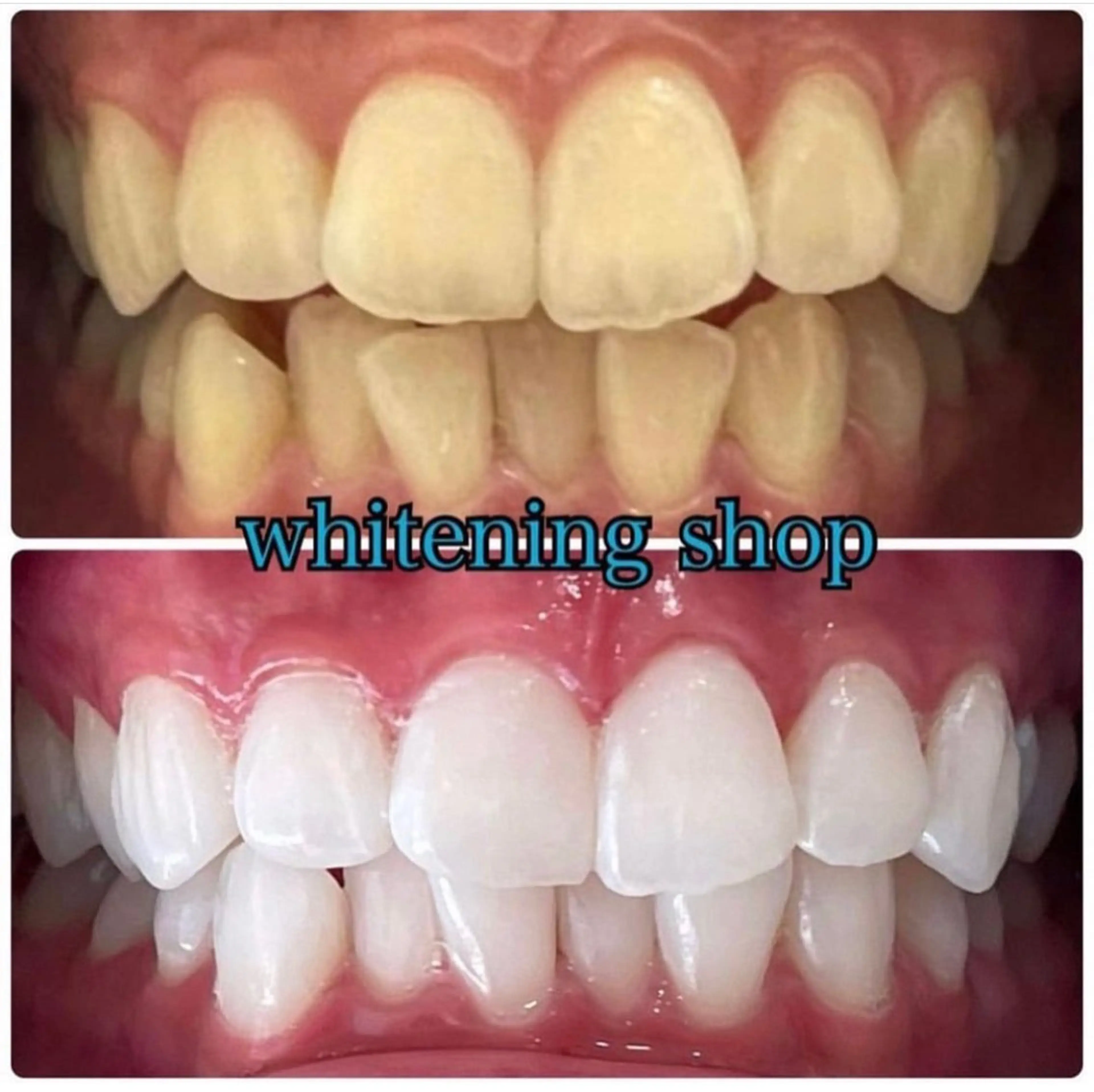 エステ リラク ホワイトニング ショップ吉祥寺店のエステ・リラクイメージ