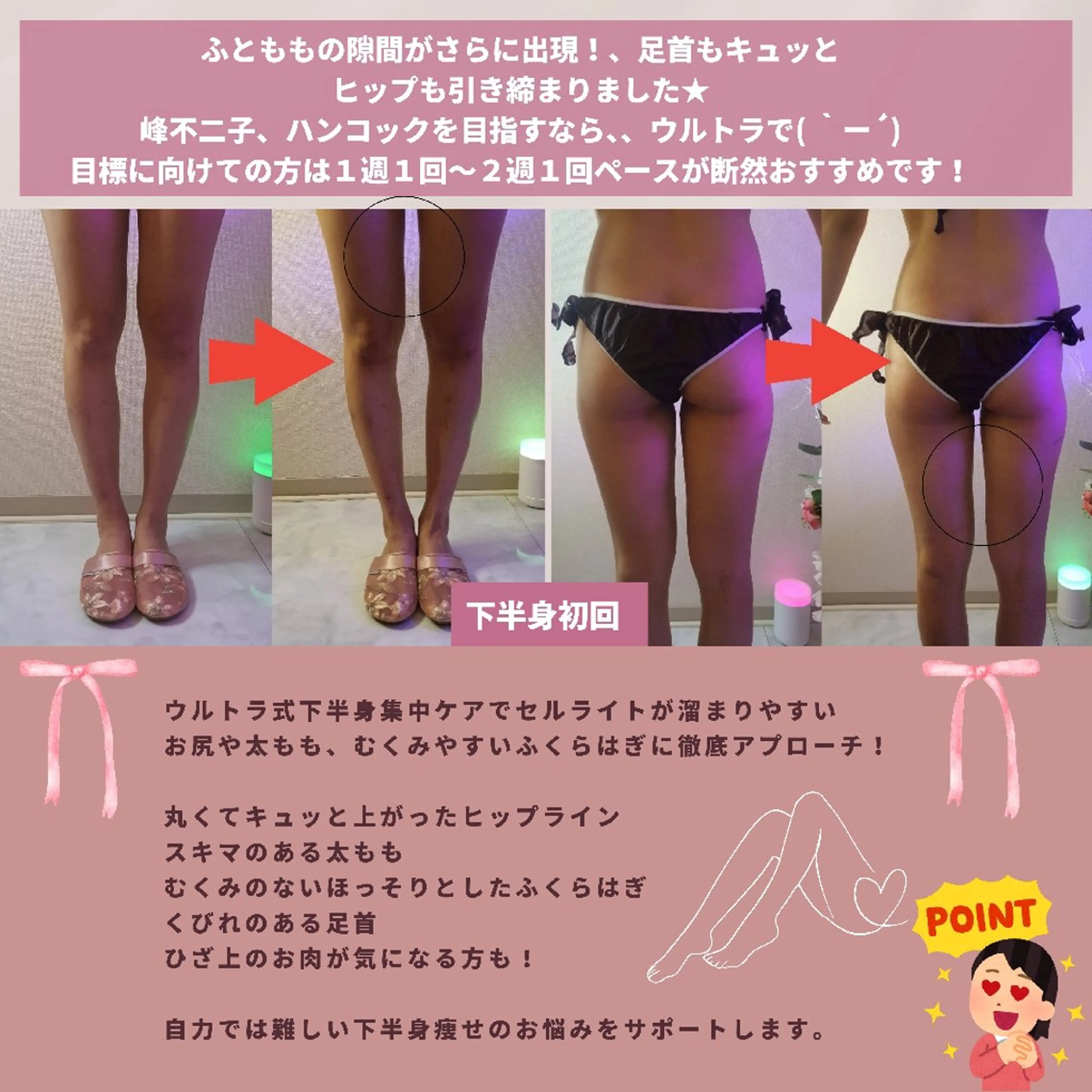 痩身ハーブピーリング 筋膜リリース☆B&Hのエステ・リラクイメージ