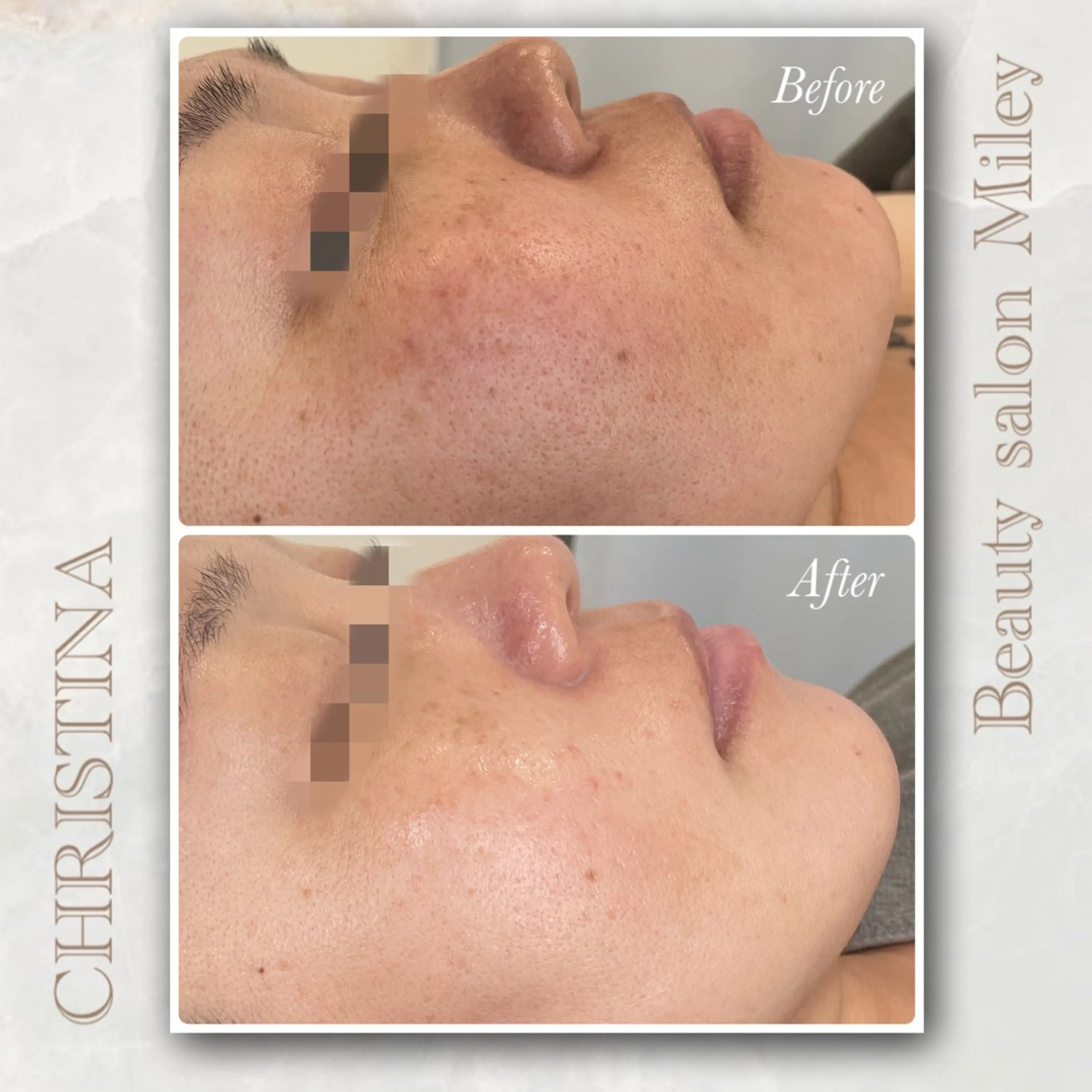 Miley/肌質改善 Megumiのエステ・リラクイメージ