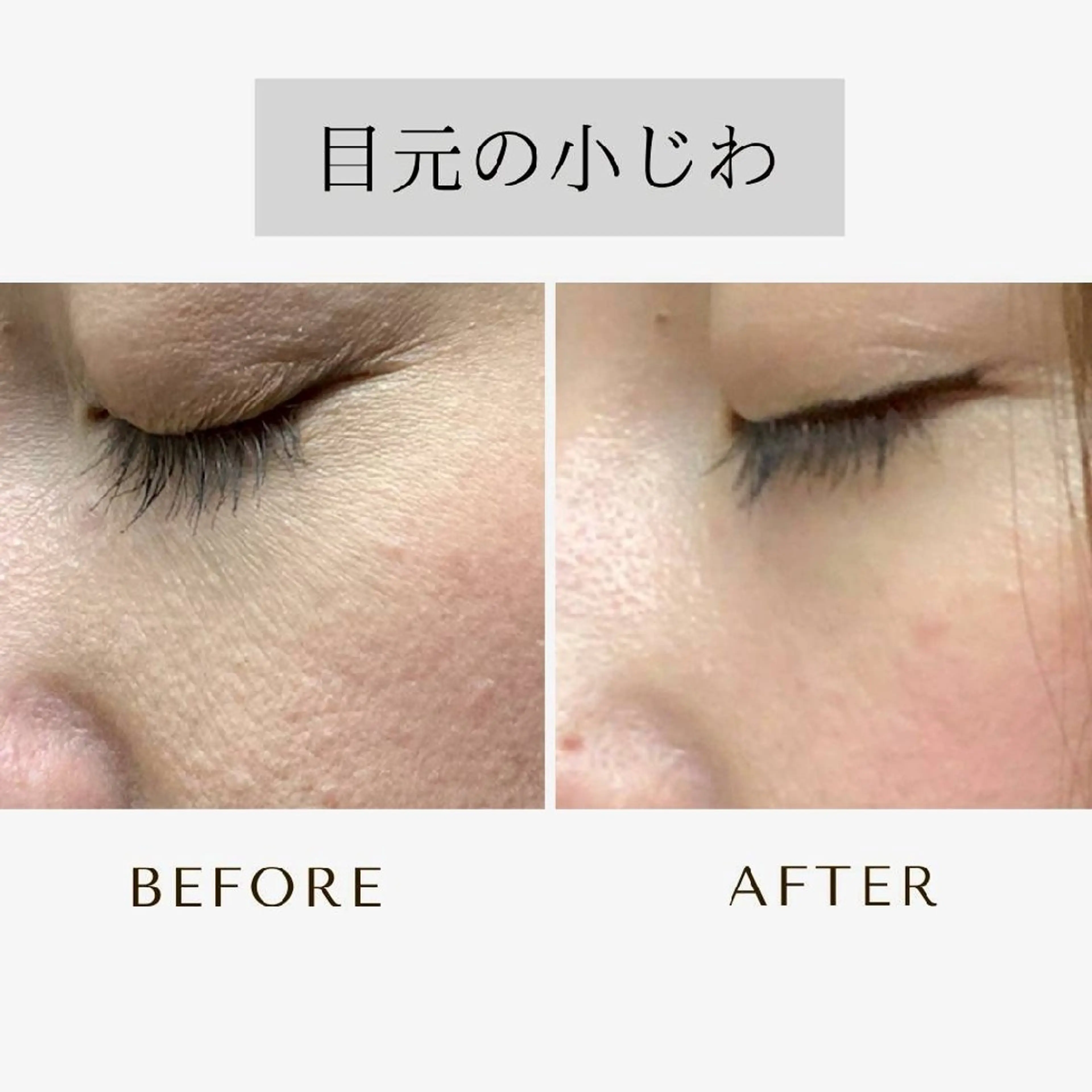 エステ ICHOOSE/ 代々木上原のエステ・リラクイメージ