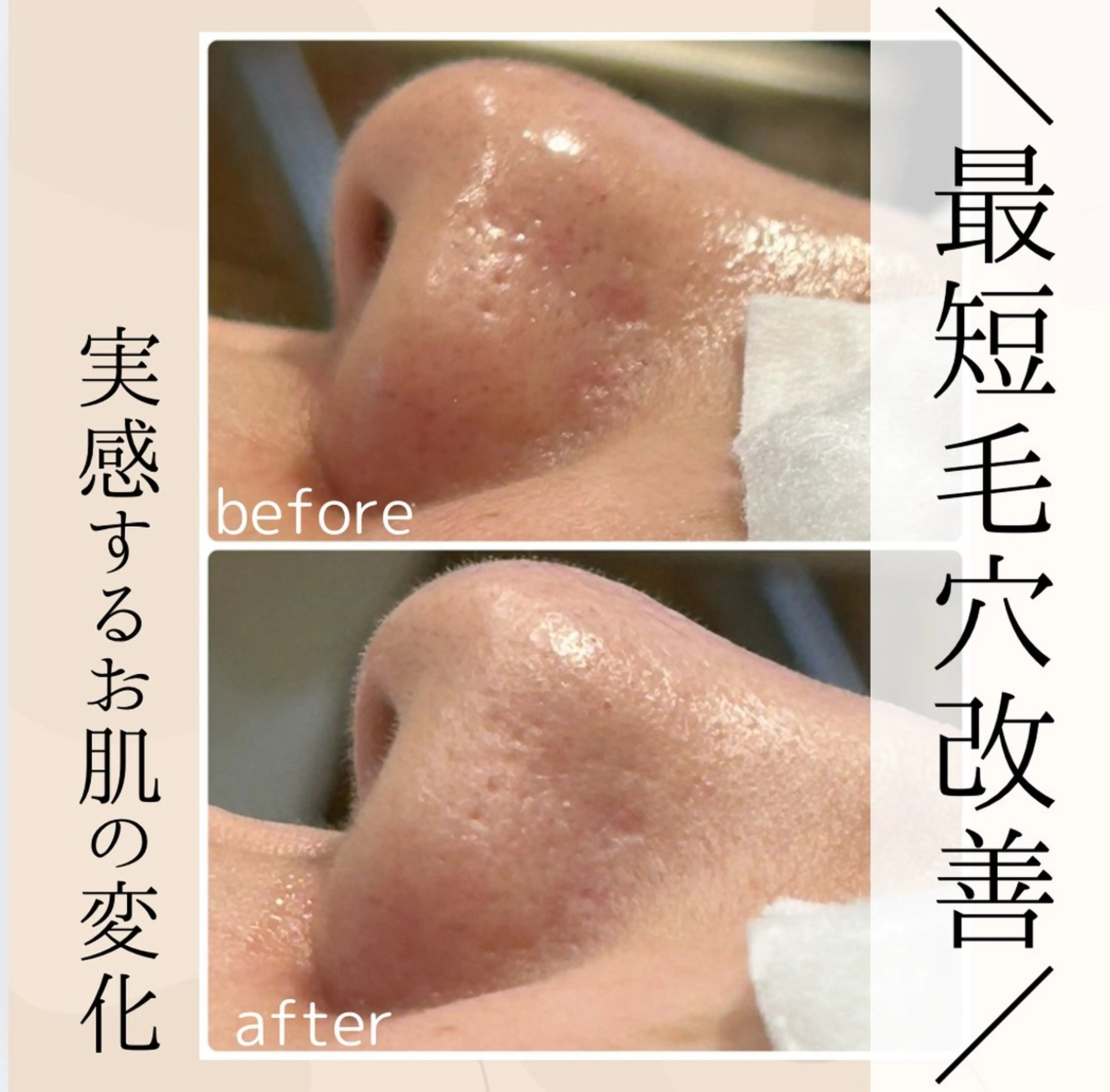 エステ 小顔・毛穴・たるみ ネイル　似内真樹のエステ・リラクイメージ