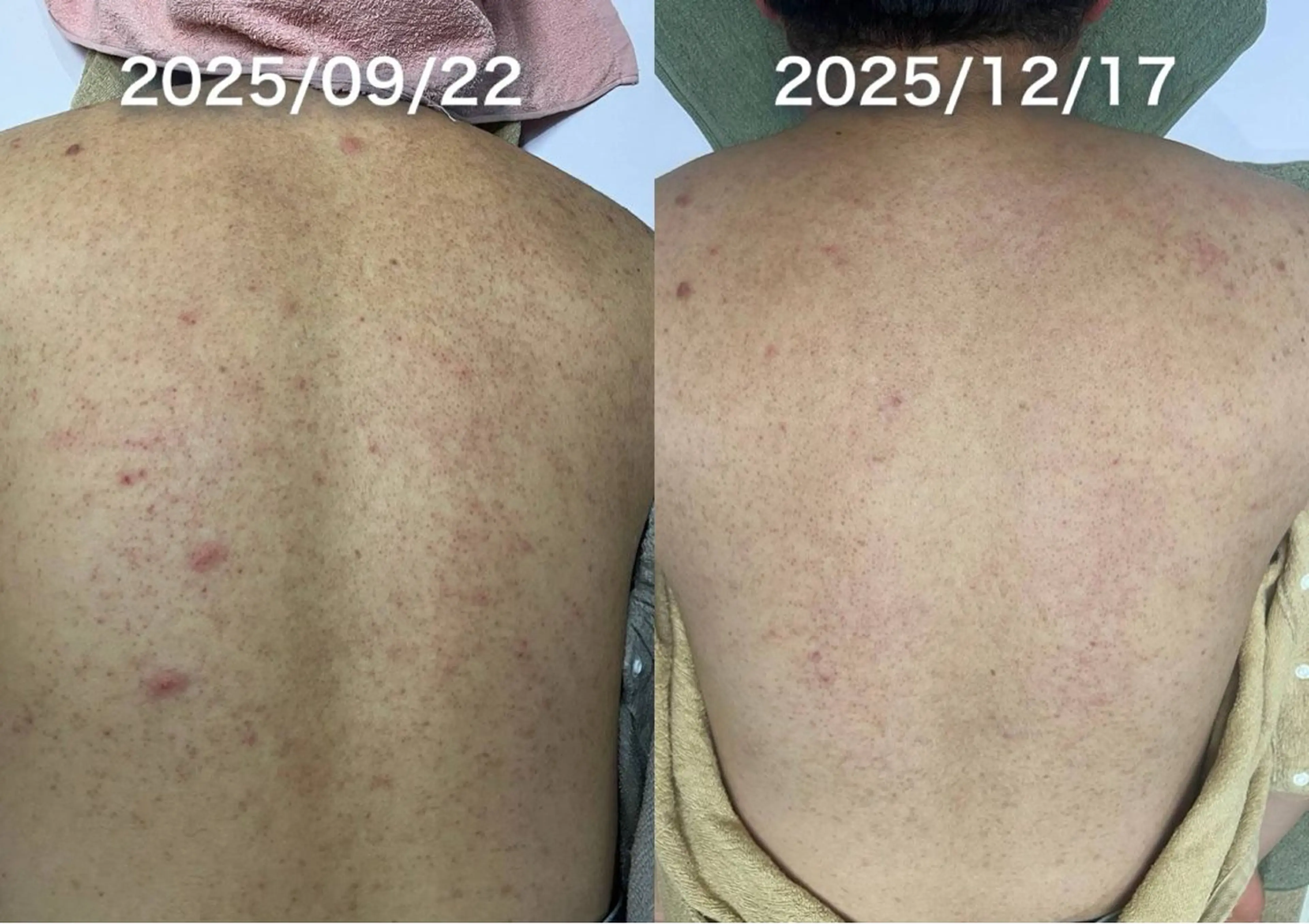 リラク 韓国美肌/肌質改善 【天神】のエステ・リラクイメージ