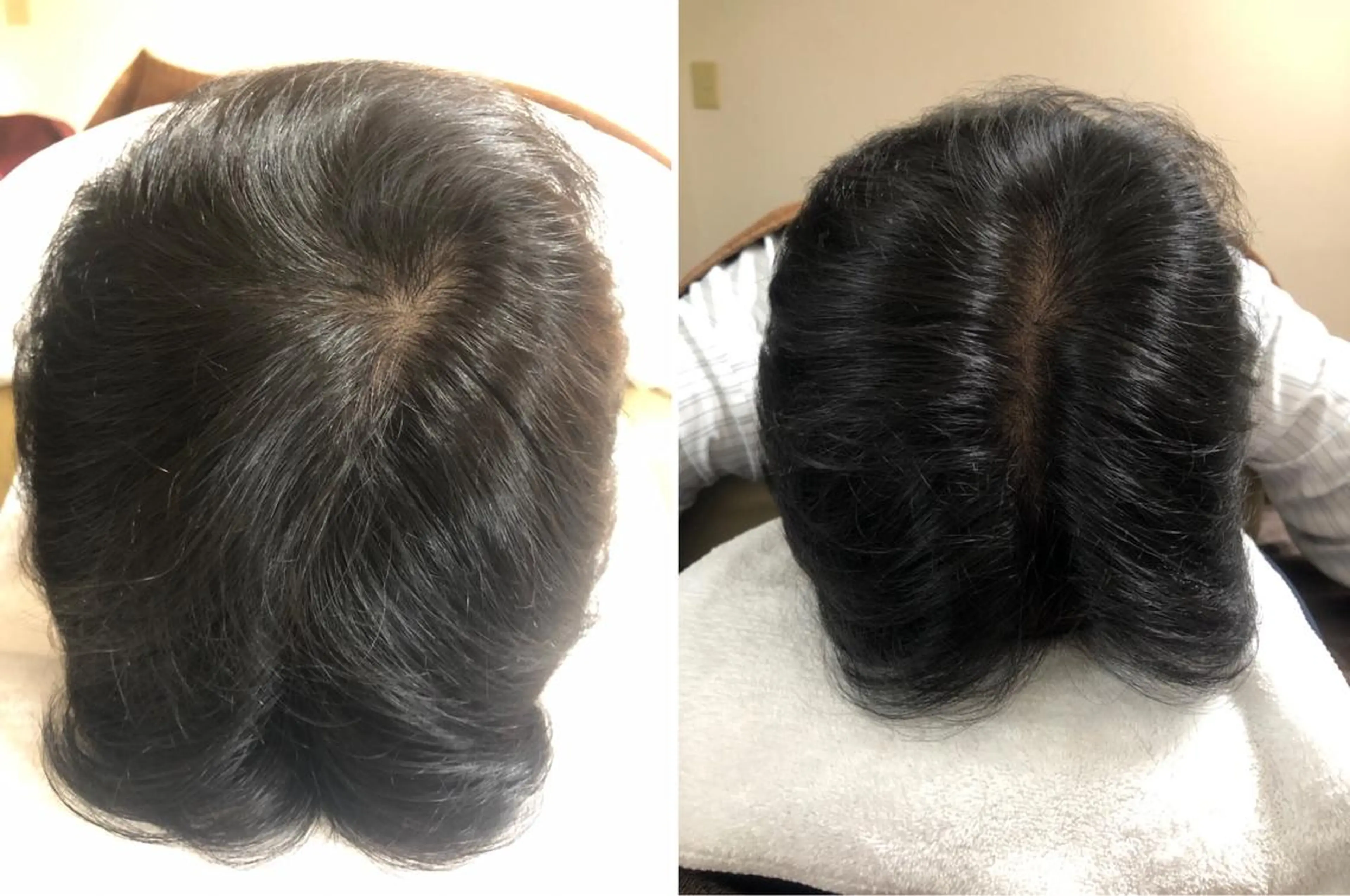 ショート メンズ セントラル鍼灸院 Re:laxyのヘアスタイル