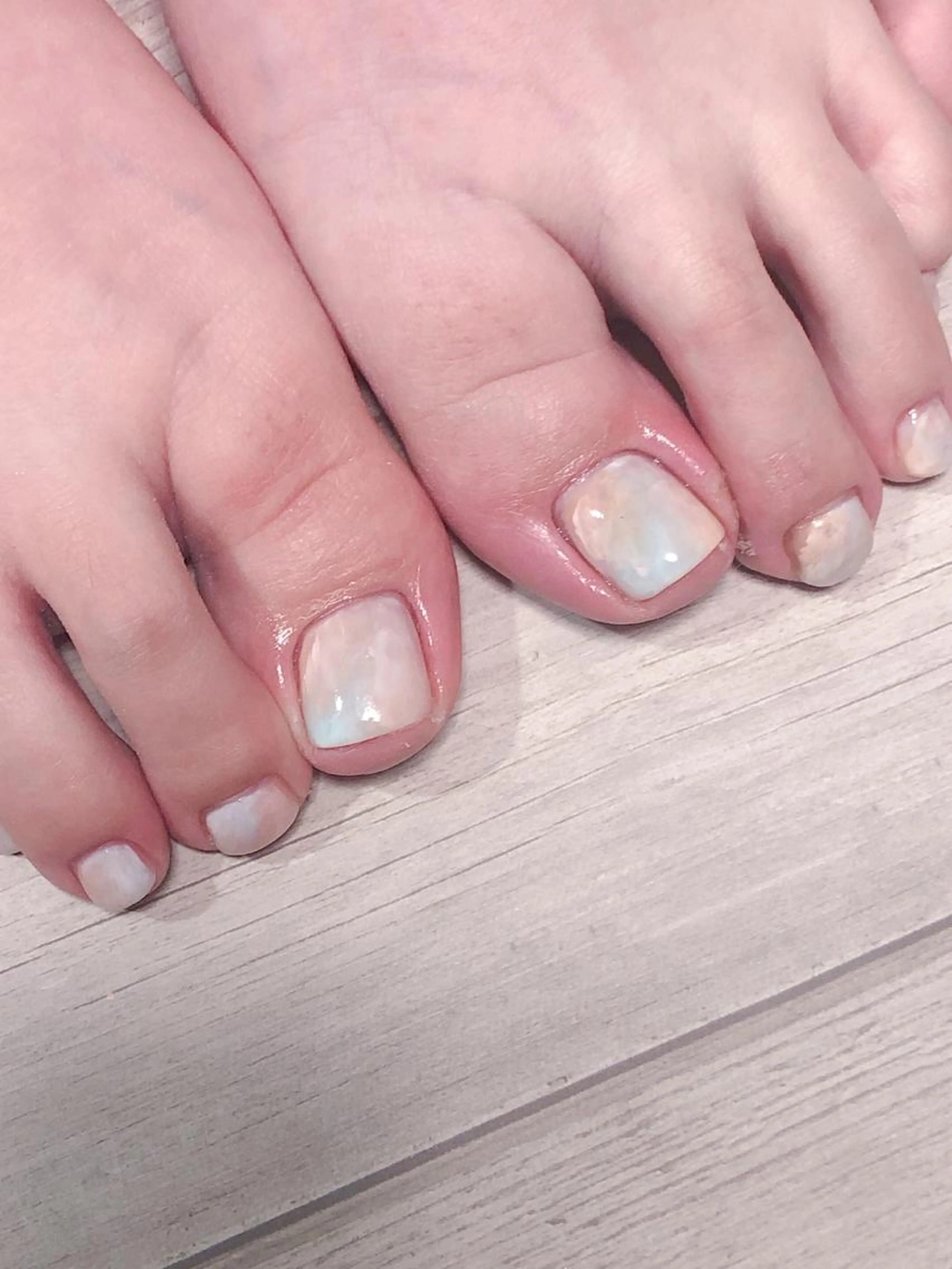 フットジェルやり放題の写真