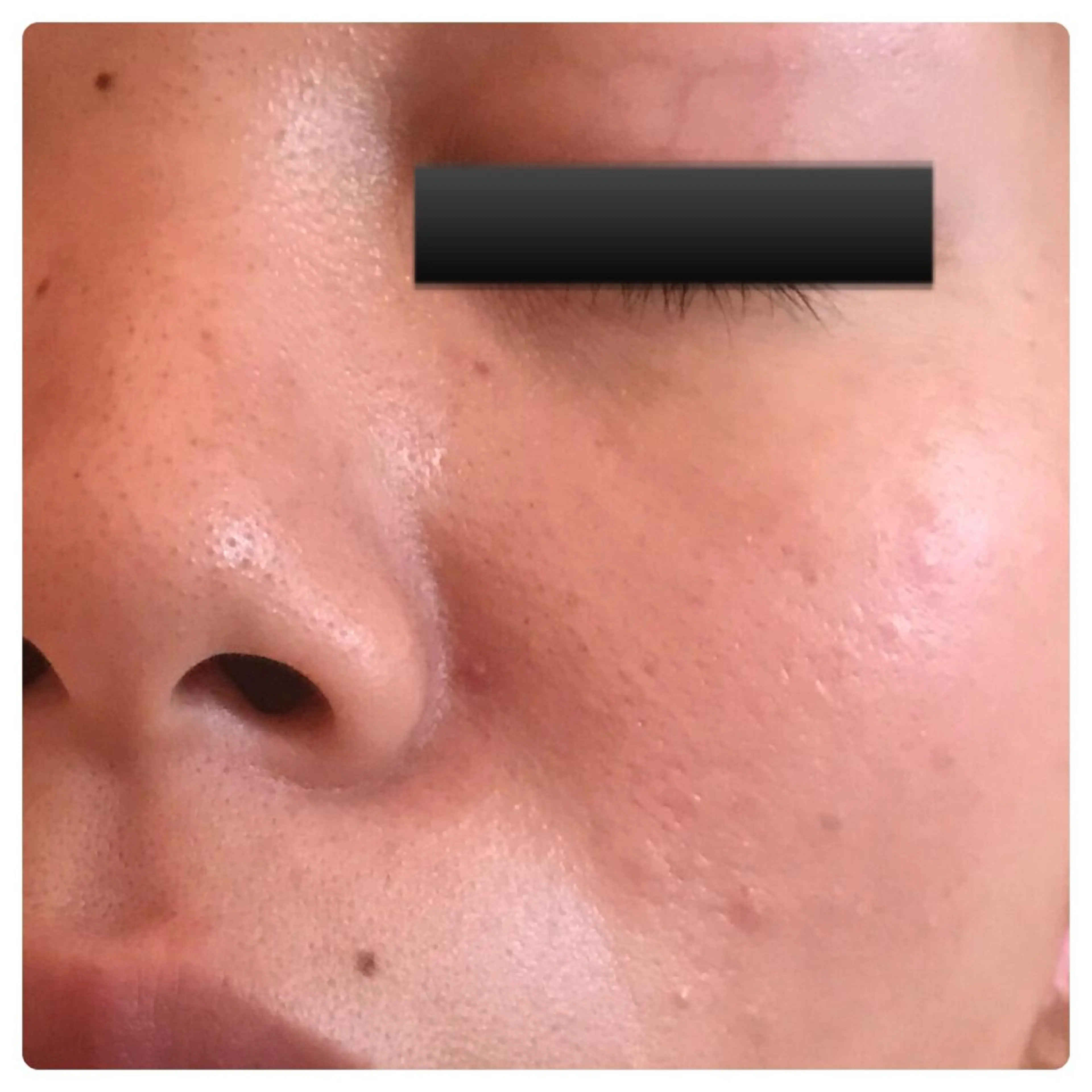 フェアリーローズ所属・fairyrose organicエステのエステ・リラクイメージ