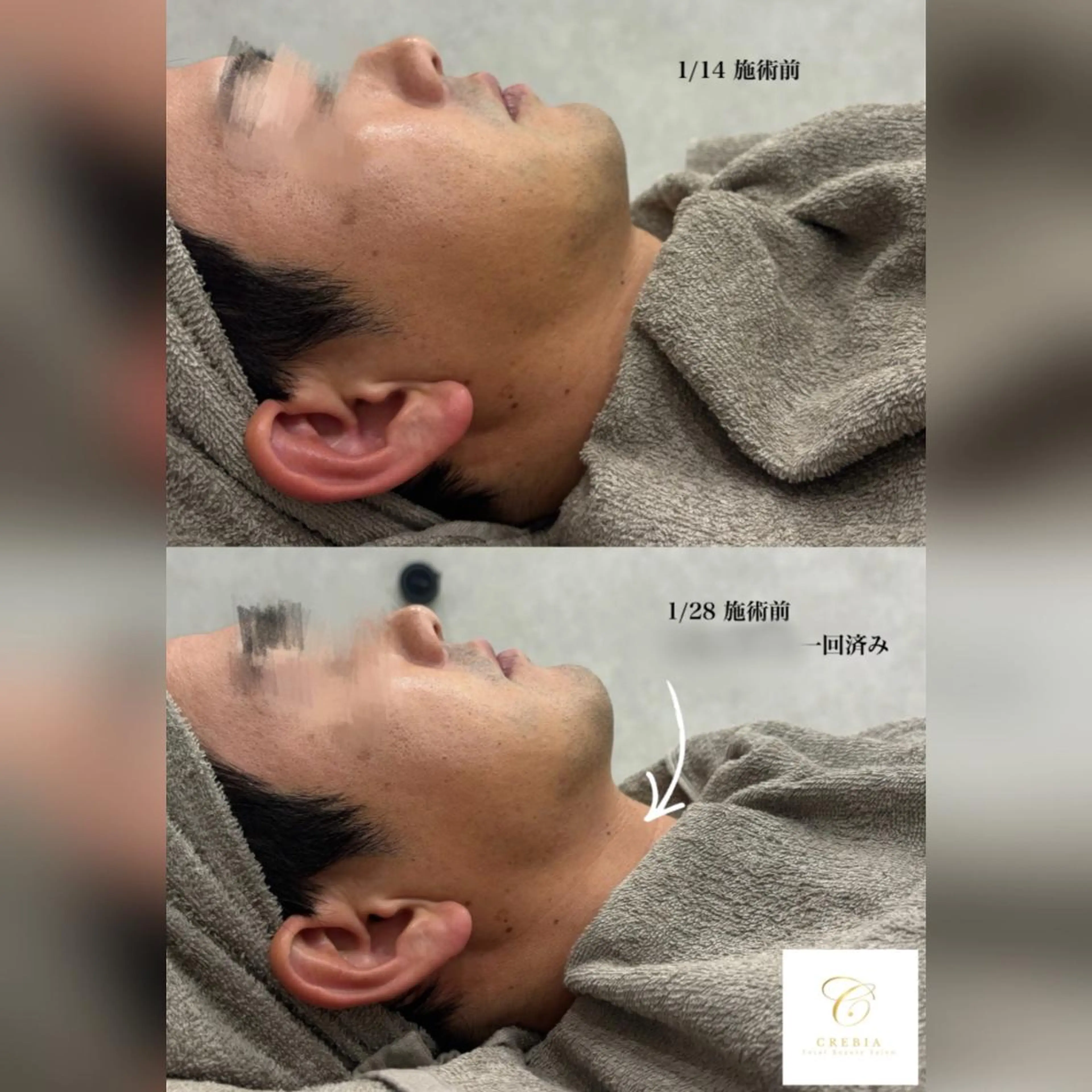 心斎橋🤍堀江.小顔 ハーブ.痩身クレビアのエステ・リラクイメージ