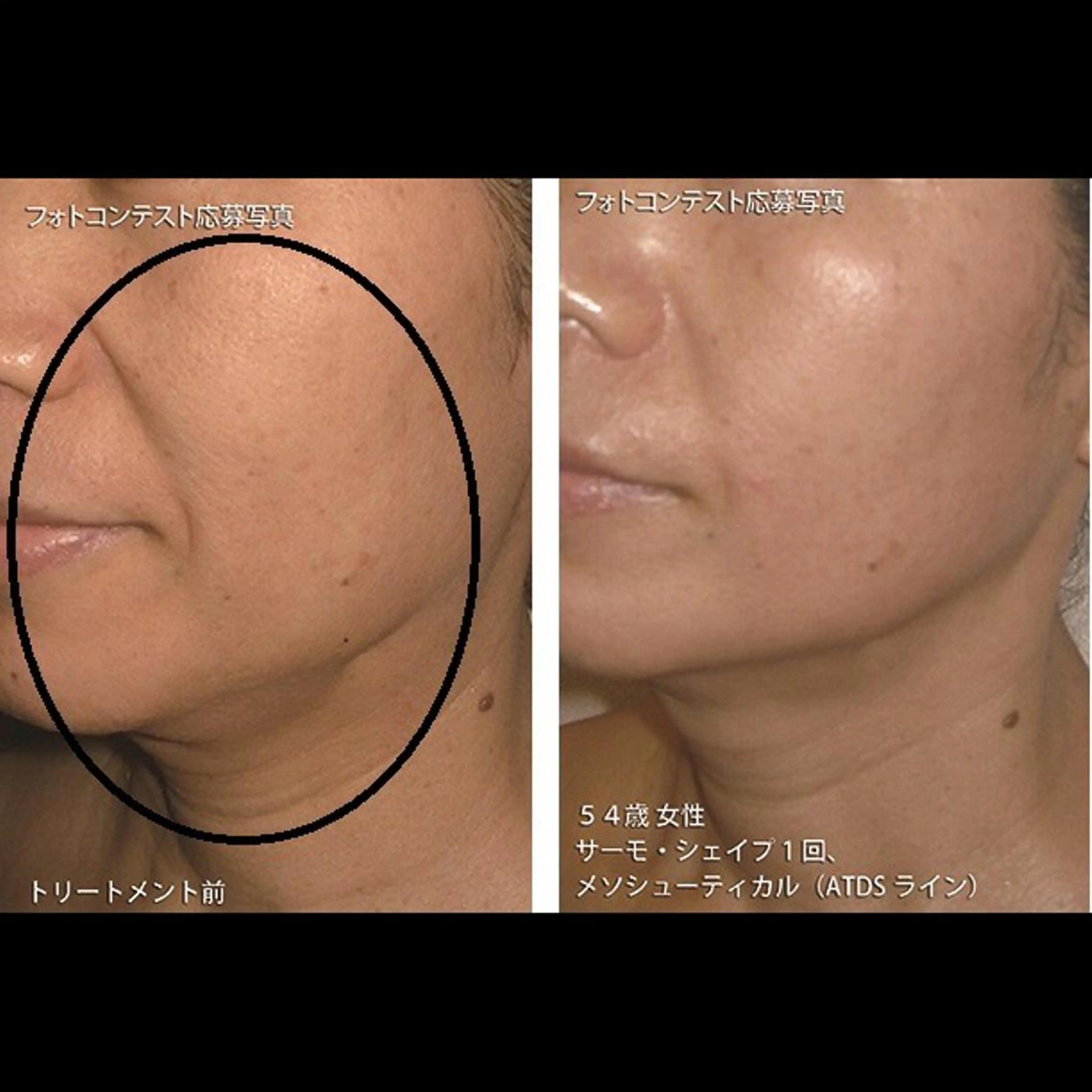 くびれ作り専門サロン こねこのシッポ虎ノ門のエステ・リラクイメージ