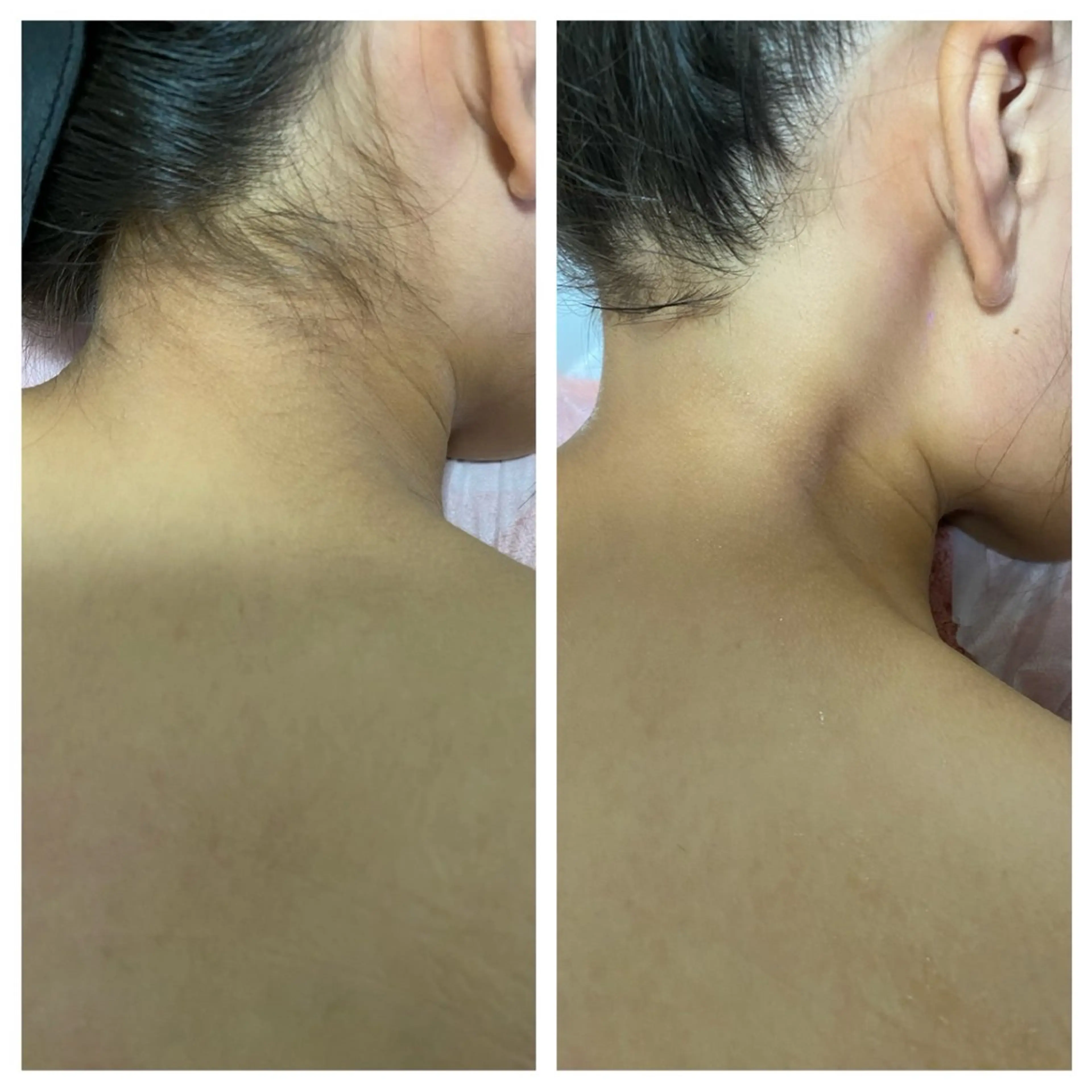 脱毛 Lumus Solarumのエステ・リラクイメージ