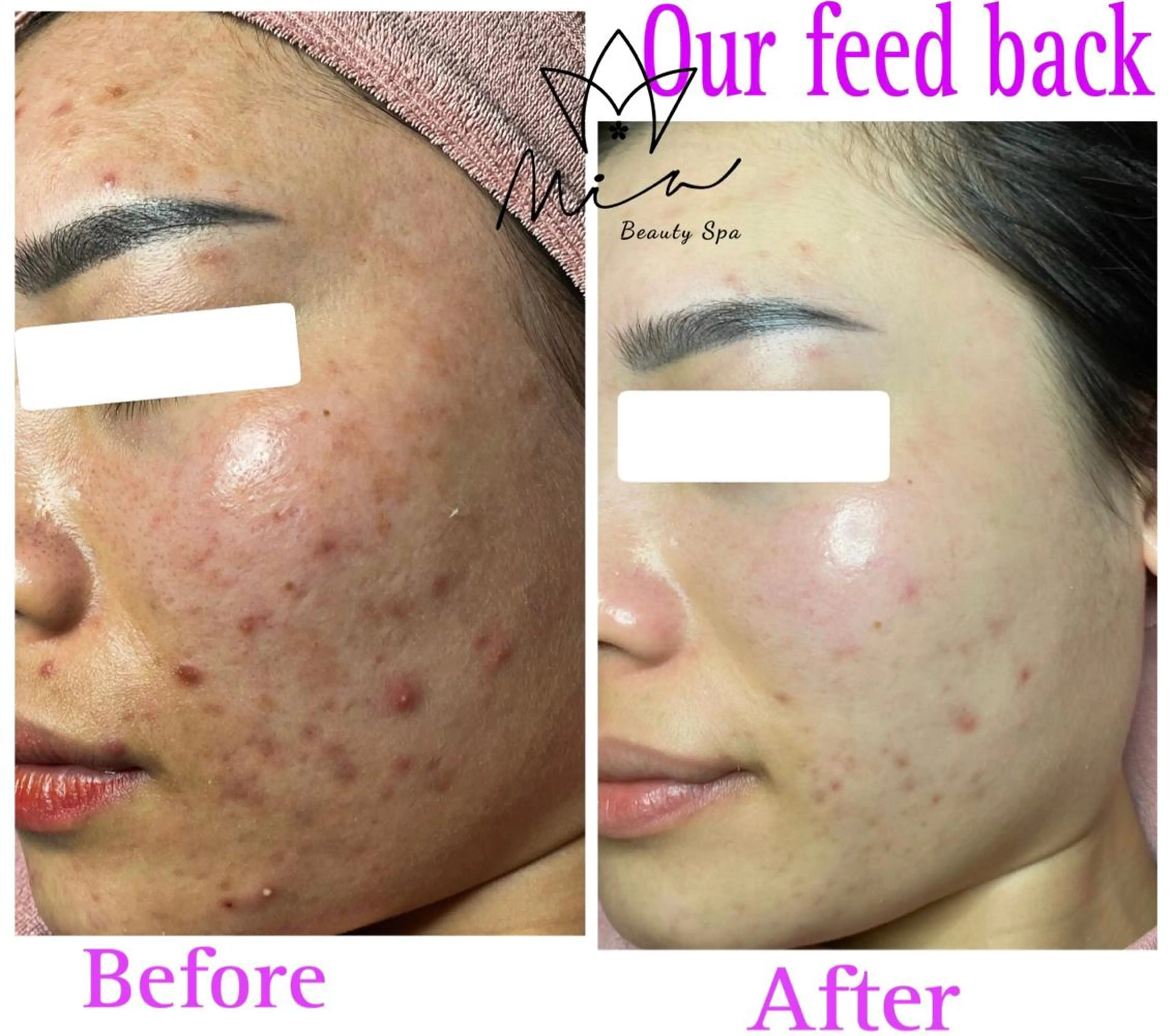 Mia beauty所属・MiA Beautyのエステ・リラクイメージ