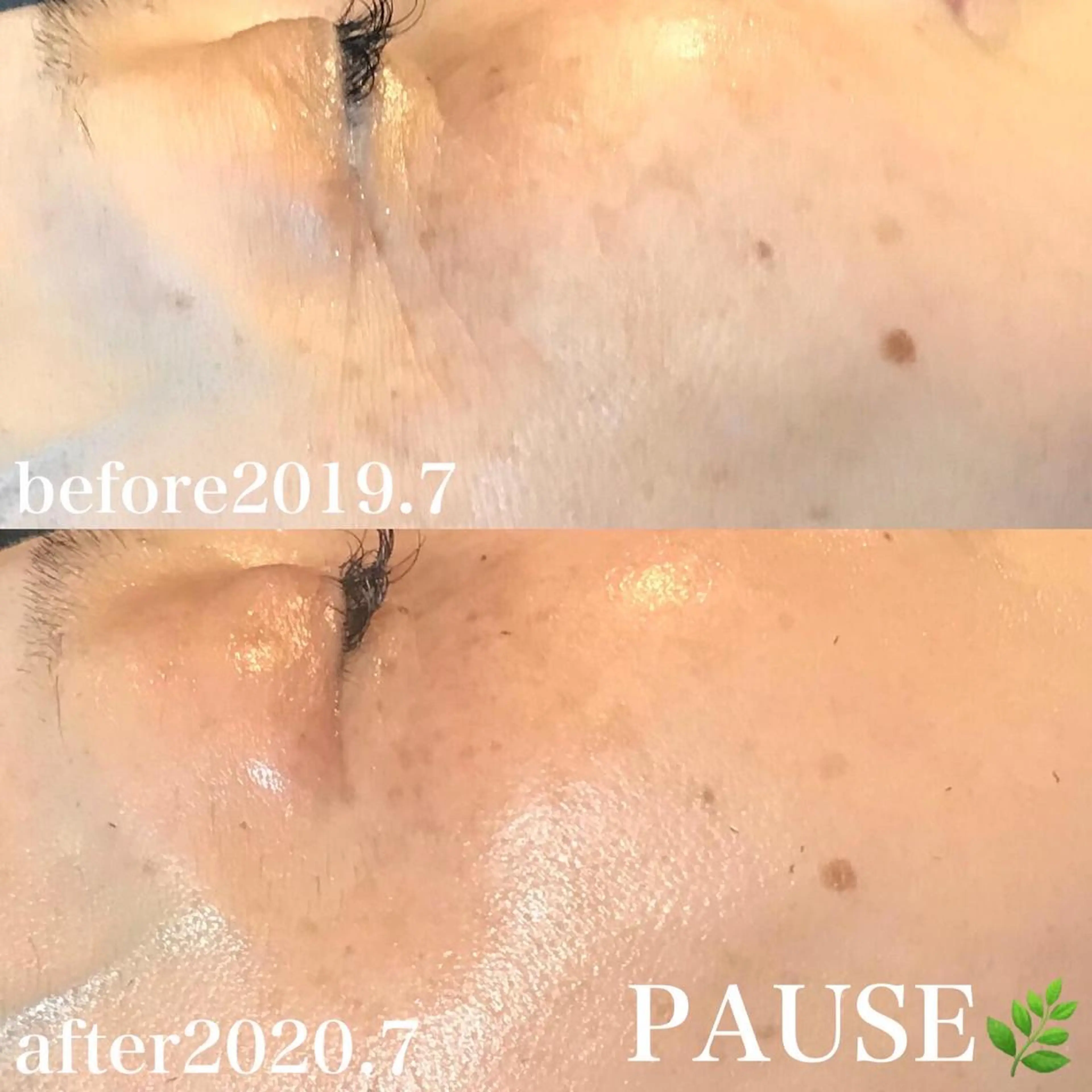 エステ 浜野 恵美のエステ・リラクイメージ